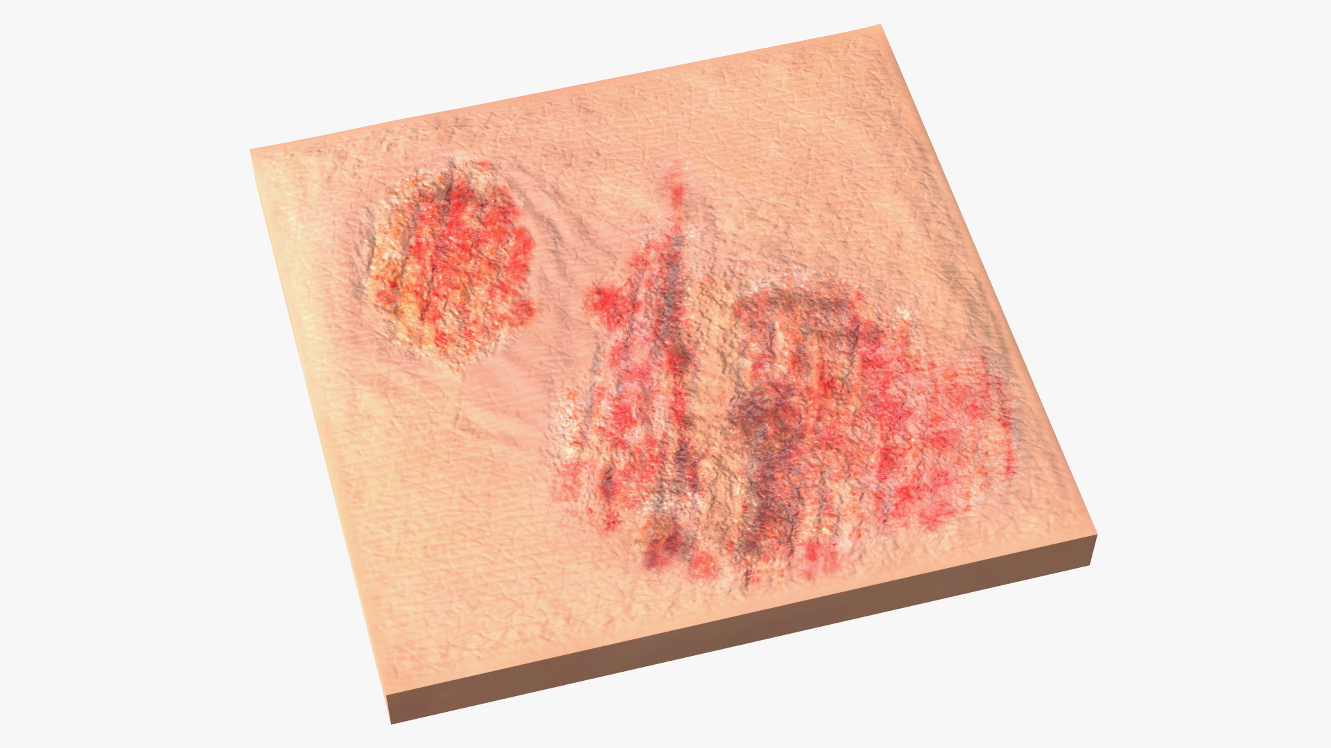 3D Grazed Skin