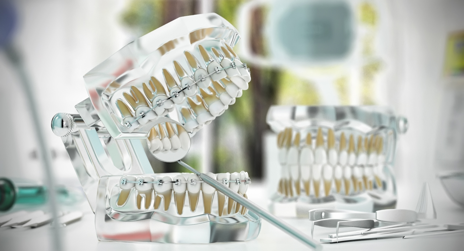 3D Transparent Dental Typodont Teeth Model With Braces