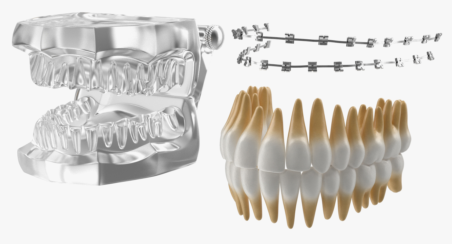 3D Transparent Dental Typodont Teeth Model With Braces