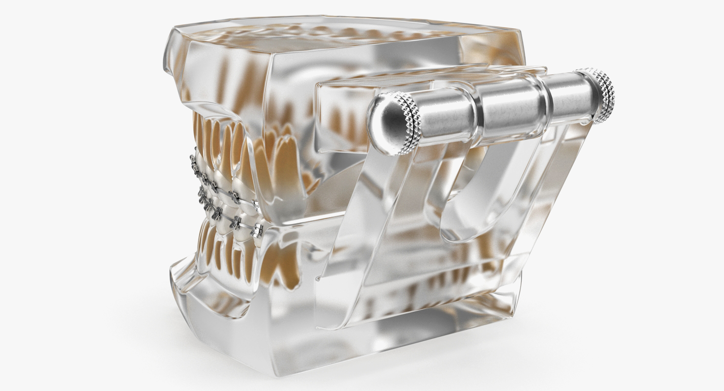 3D Transparent Dental Typodont Teeth Model With Braces