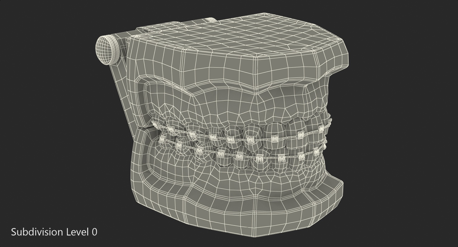 3D Transparent Dental Typodont Teeth Model With Braces
