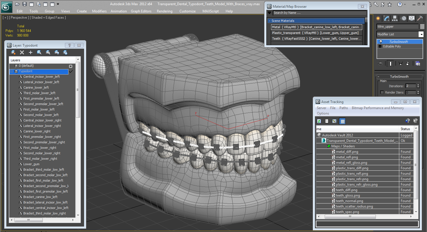 3D Transparent Dental Typodont Teeth Model With Braces