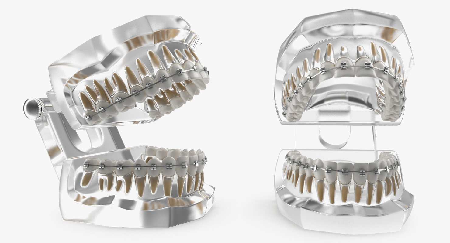 3D Transparent Dental Typodont Teeth Model With Braces