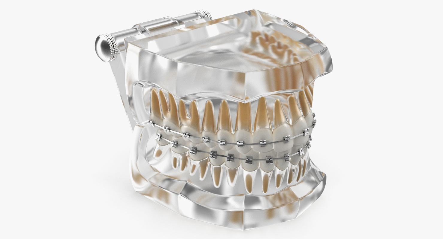 3D Transparent Dental Typodont Teeth Model With Braces
