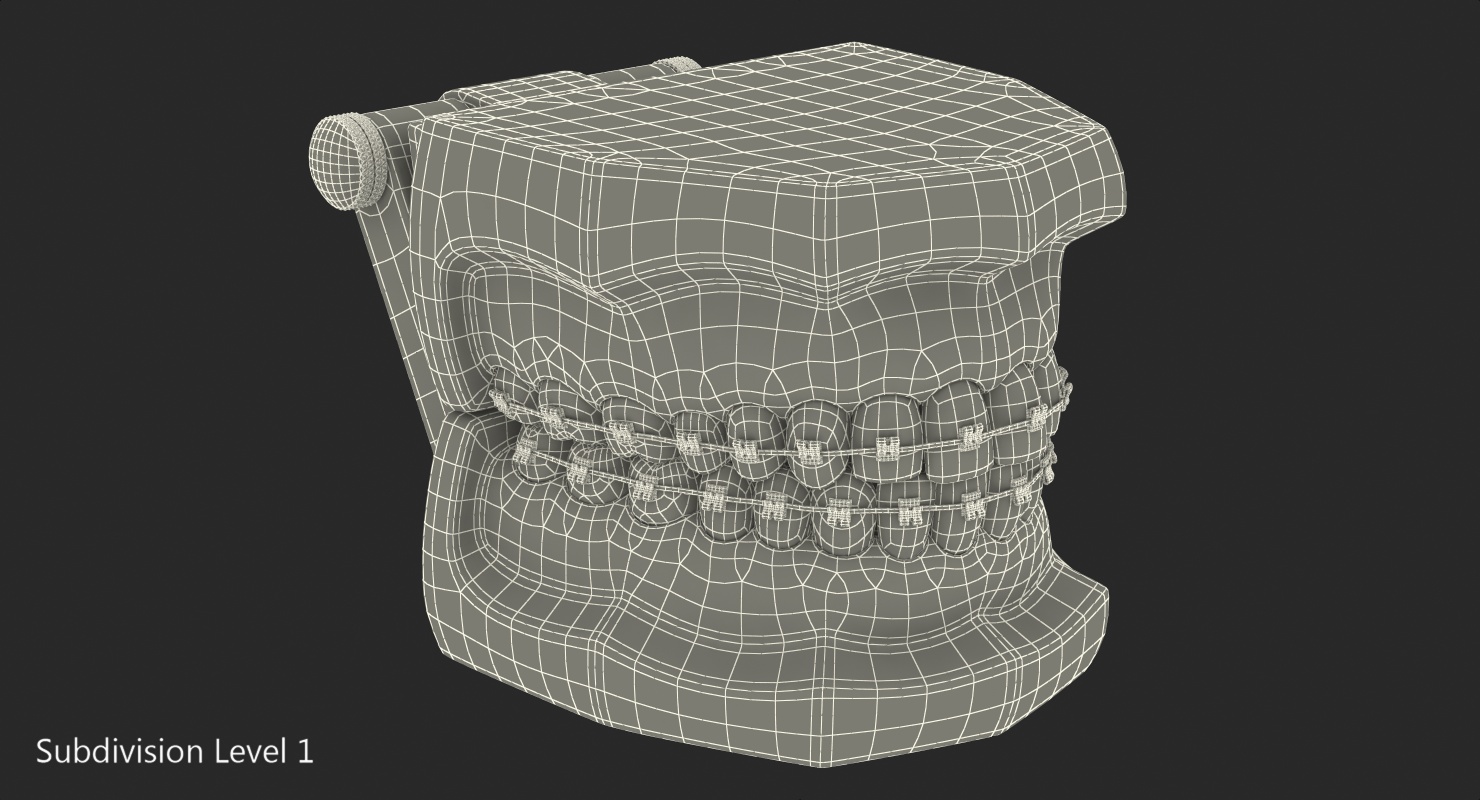 3D Transparent Dental Typodont Teeth Model With Braces