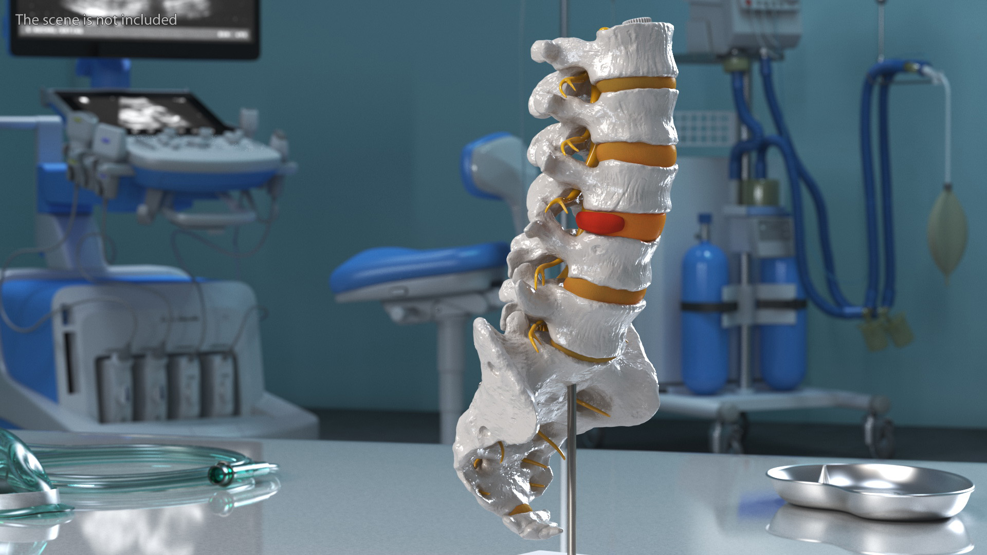 Spinal Column with Hernia on Stand 3D model