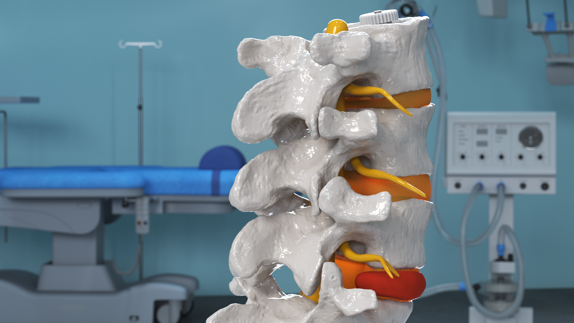 Spinal Column with Hernia on Stand, view 4