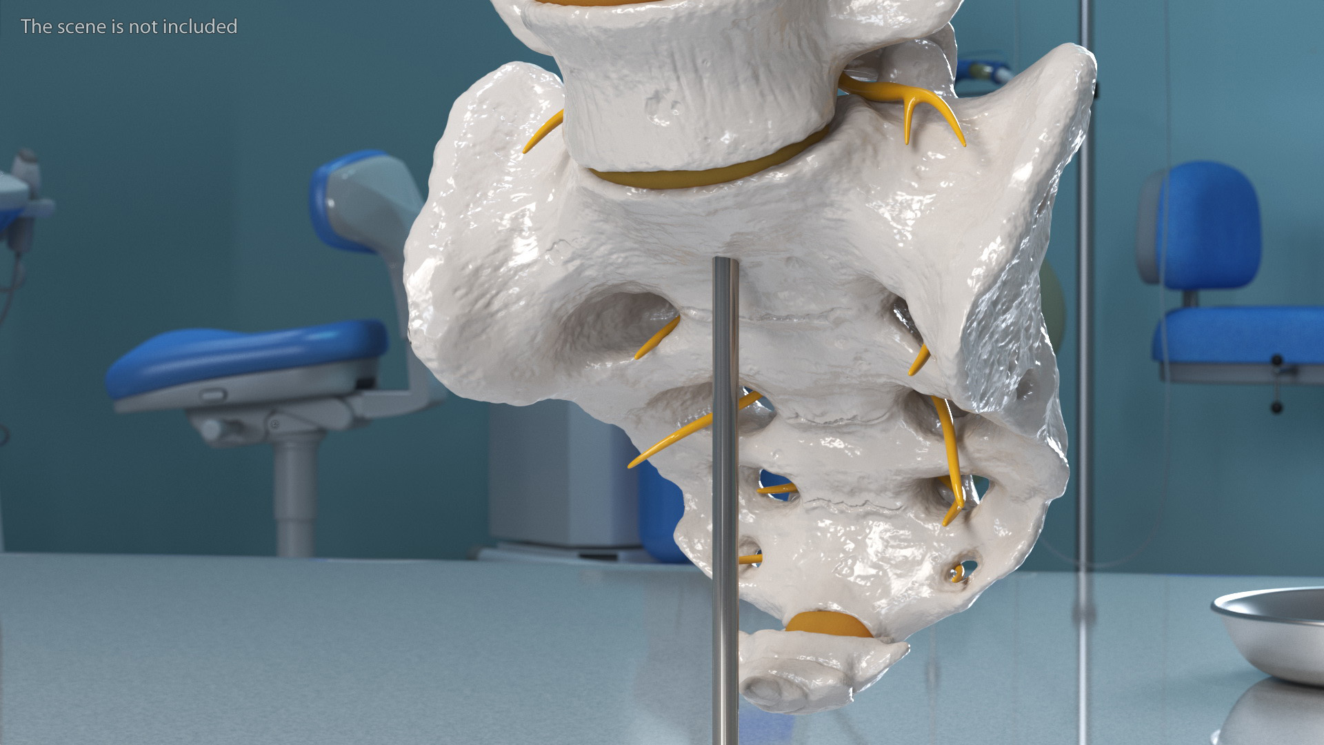 Spinal Column with Hernia on Stand 3D model