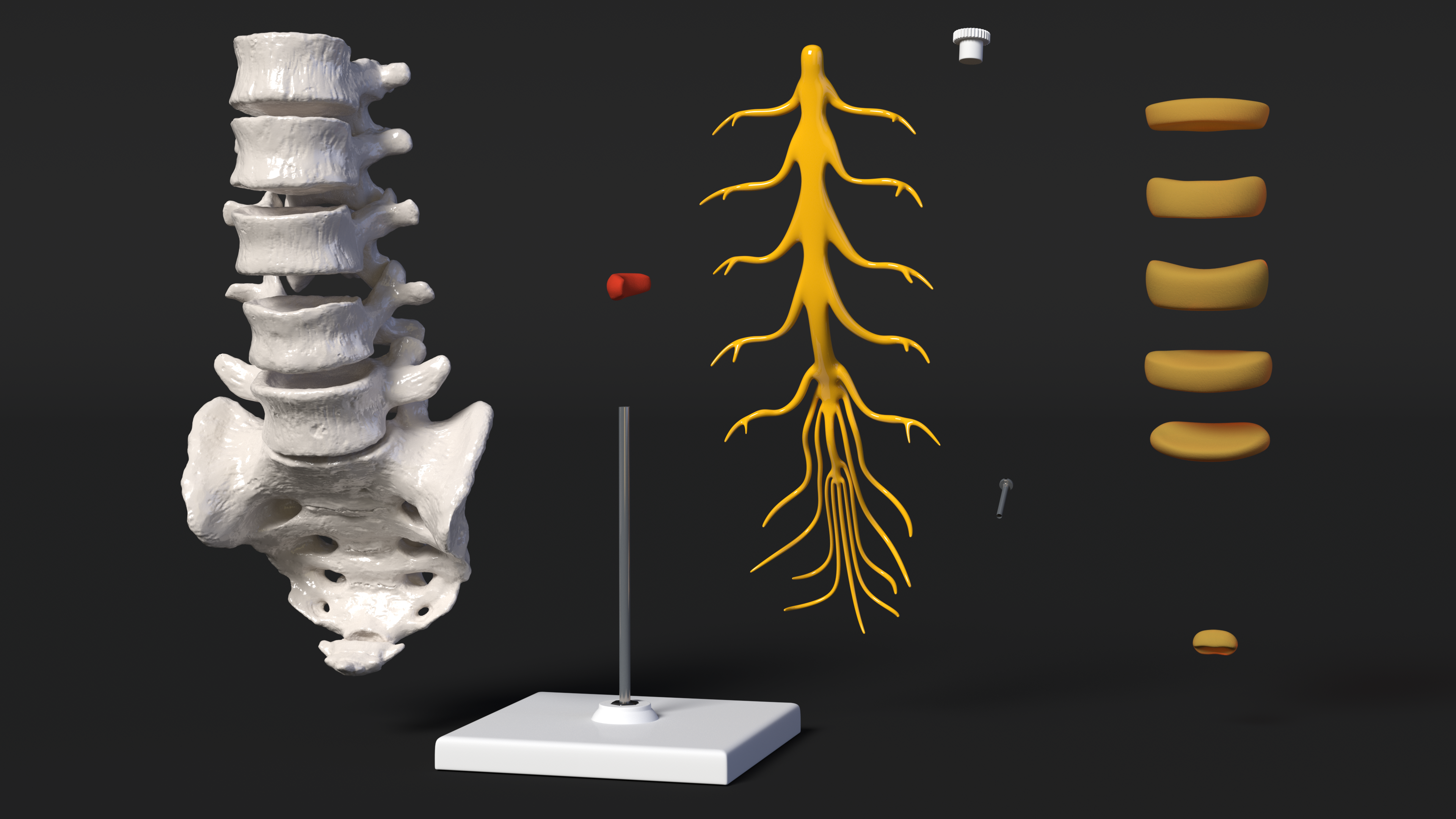 Spinal Column with Hernia on Stand, view 6