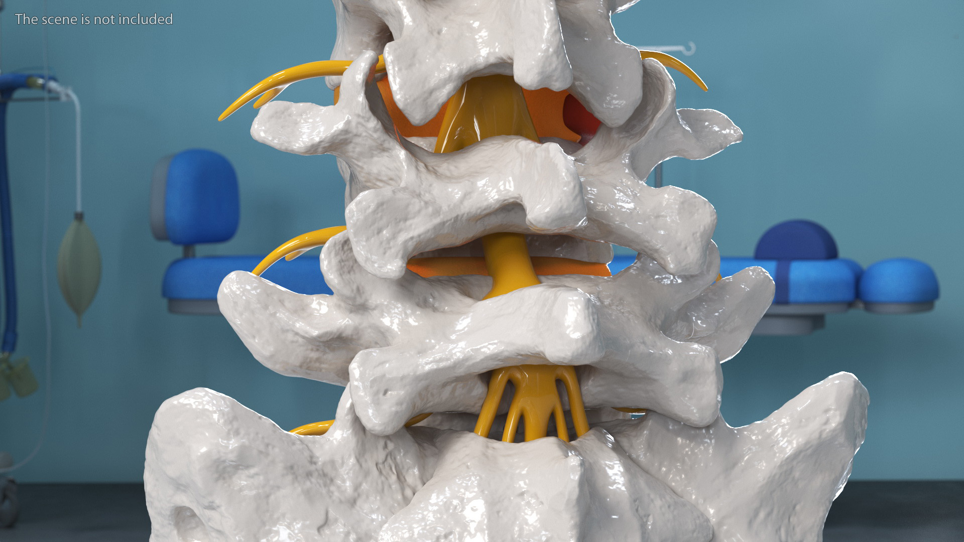 Spinal Column with Hernia on Stand 3D model
