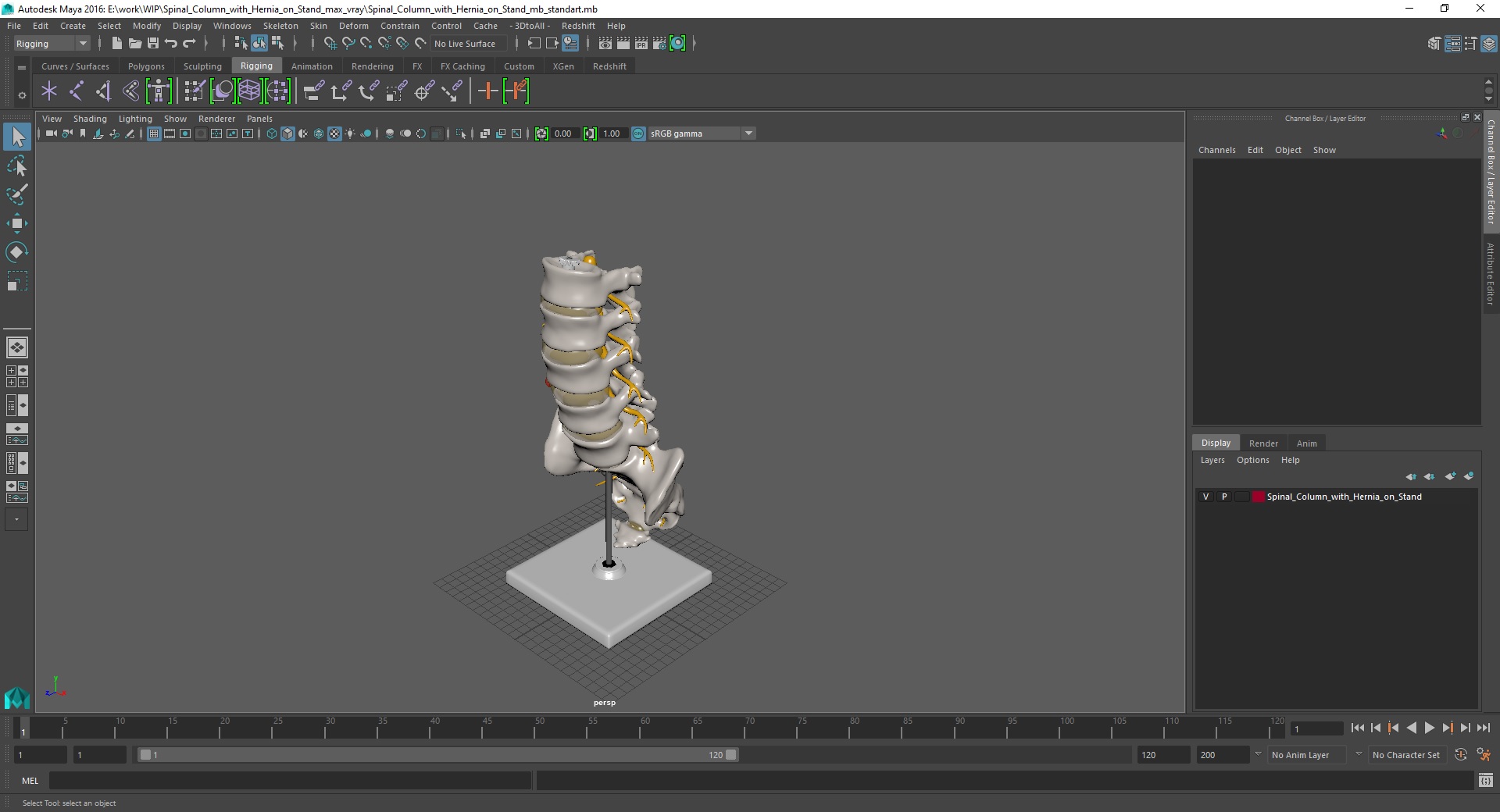 Spinal Column with Hernia on Stand 3D model