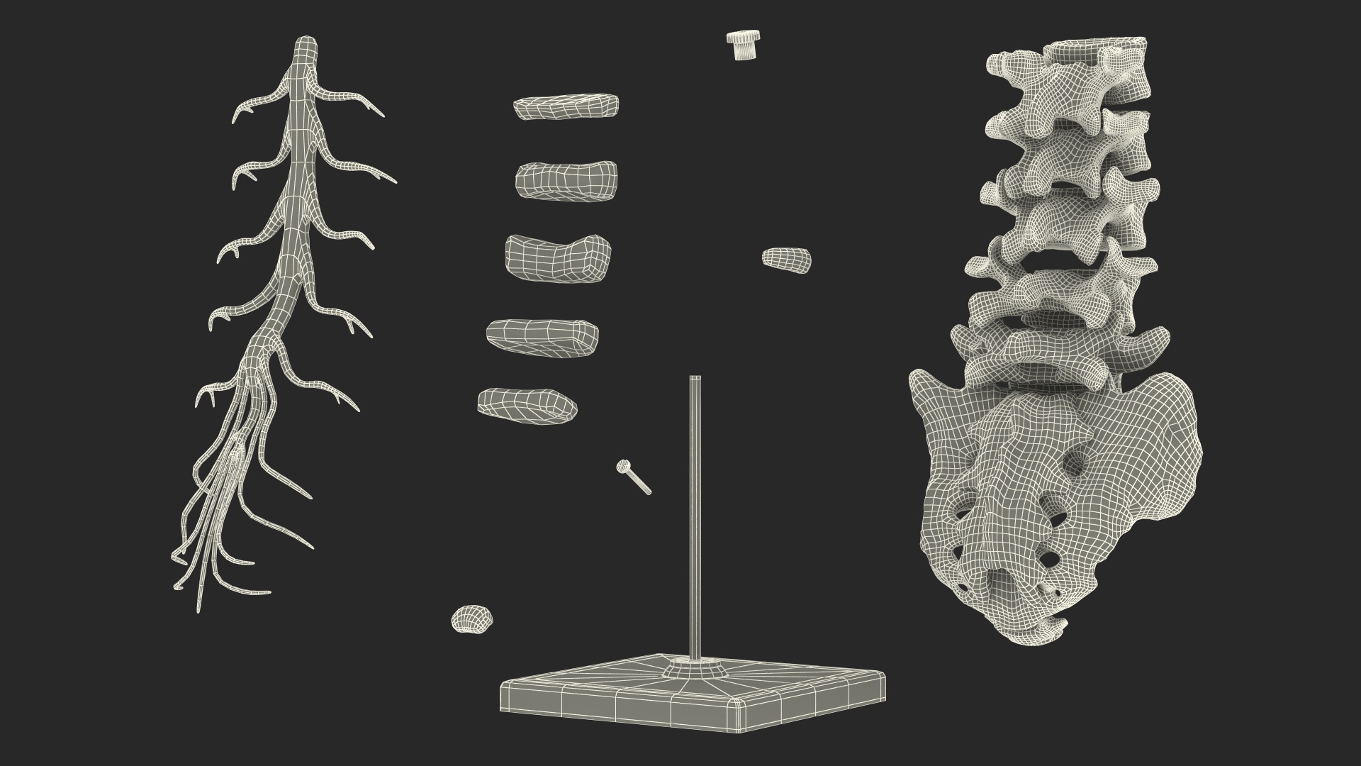 Spinal Column with Hernia on Stand 3D model