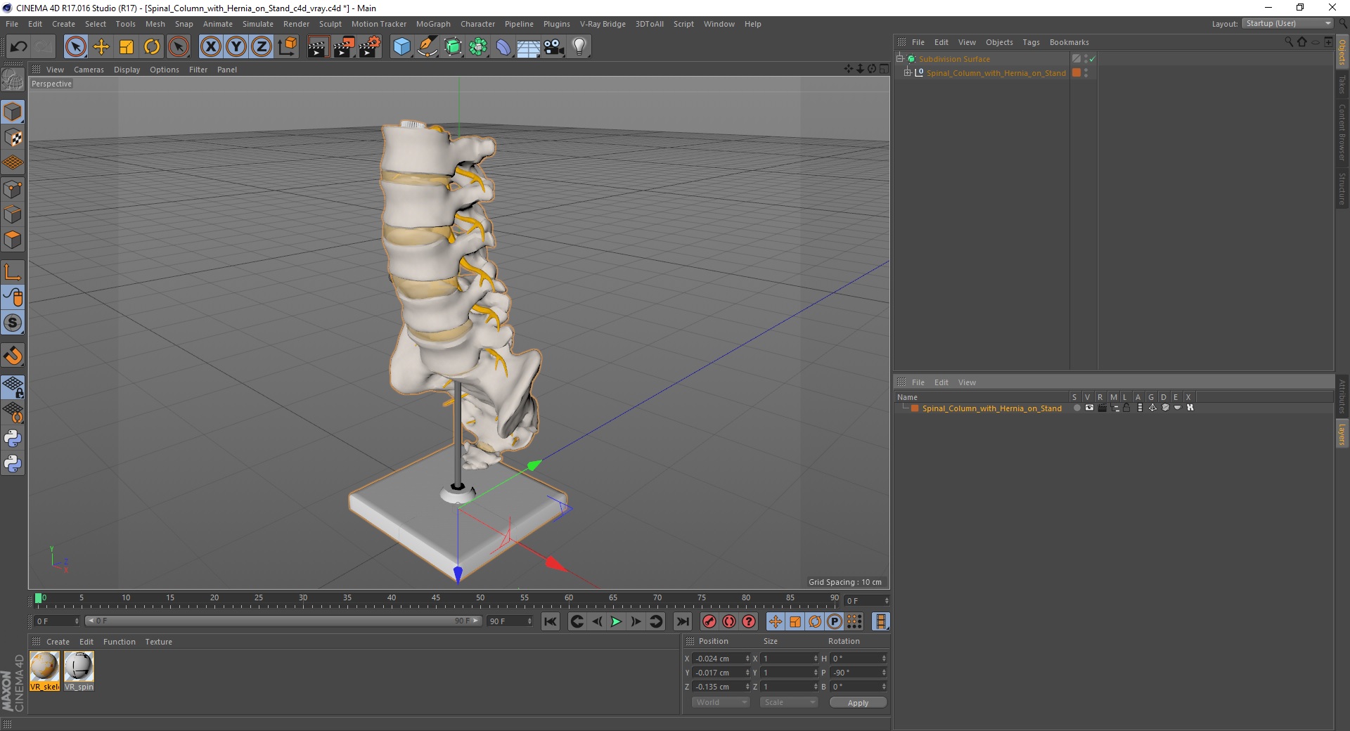 Spinal Column with Hernia on Stand 3D model
