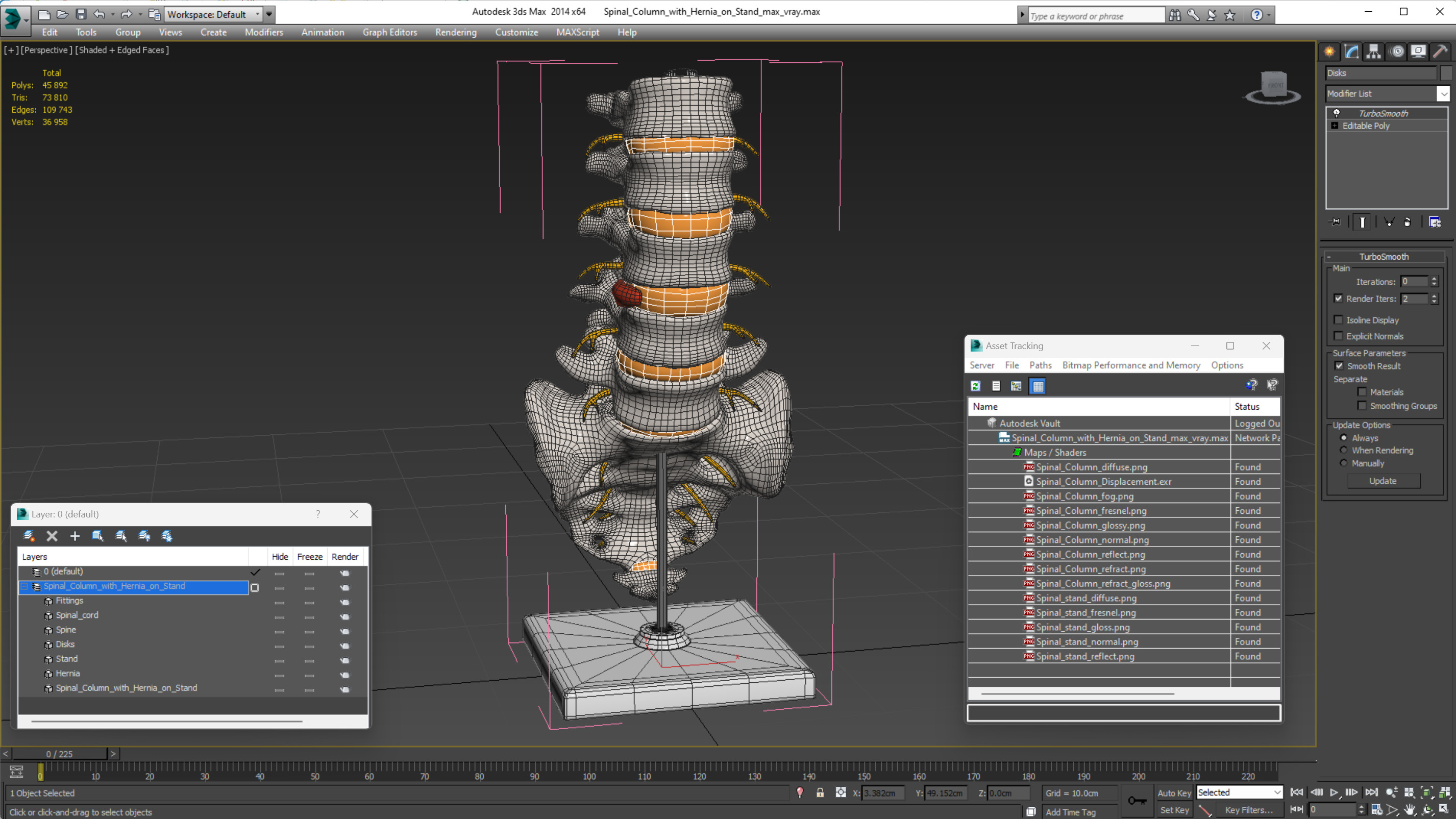 Spinal Column with Hernia on Stand 3D model