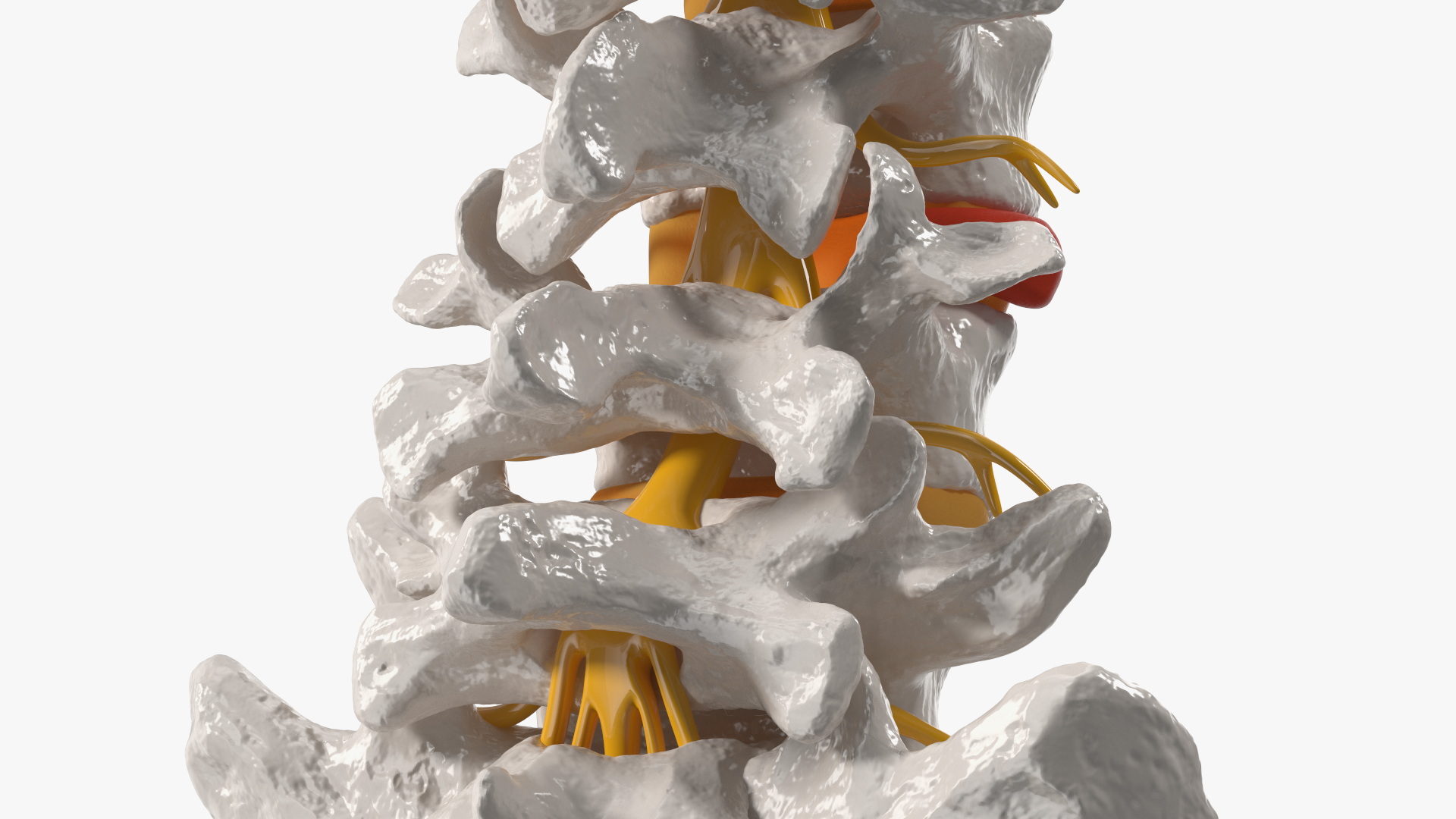 Spinal Column with Hernia on Stand 3D model