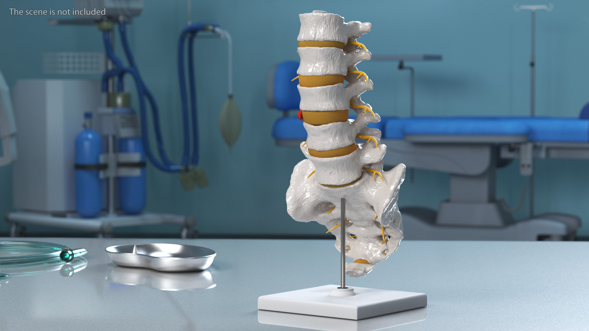 Spinal Column with Hernia on Stand 3D model