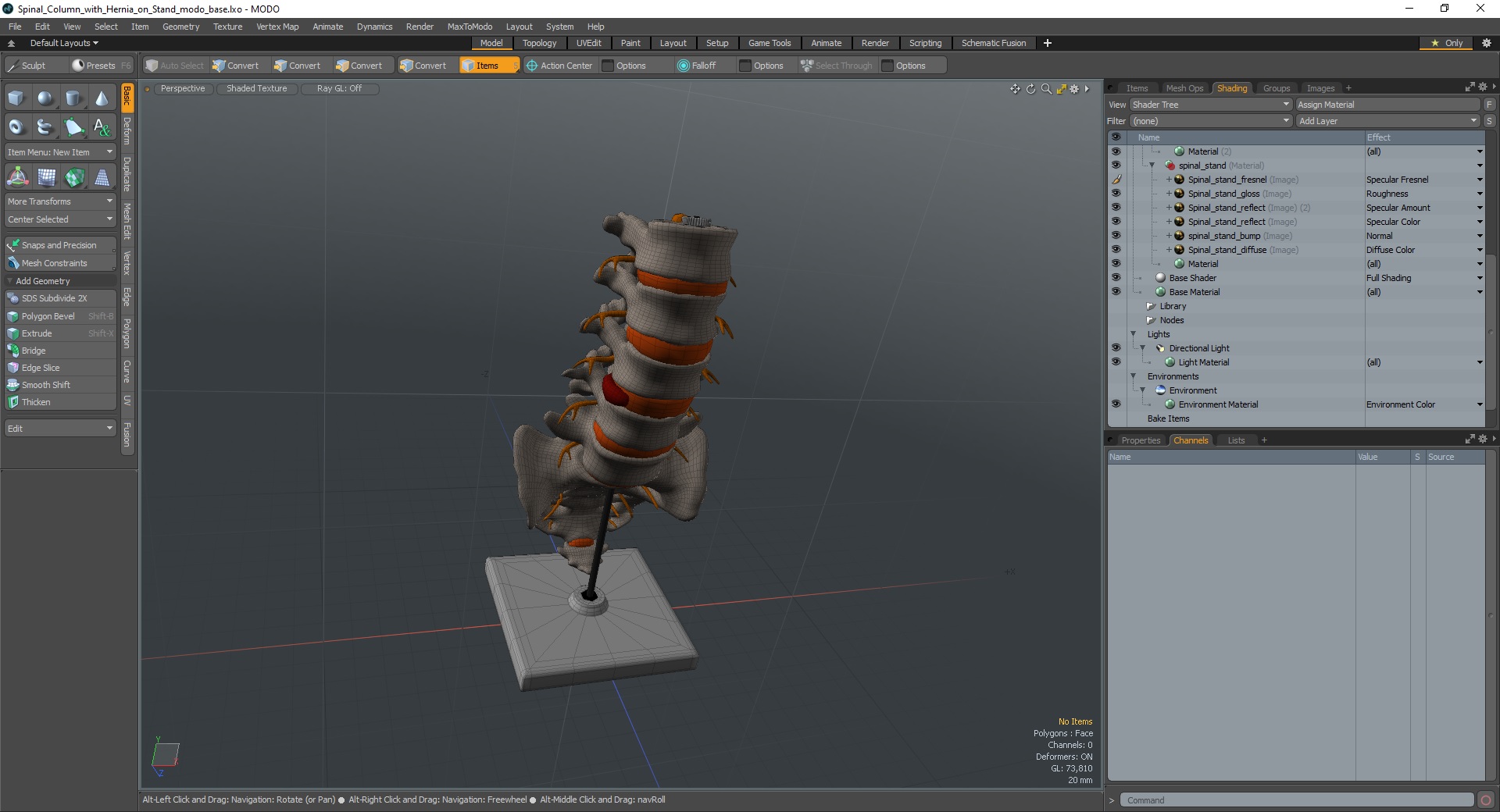 Spinal Column with Hernia on Stand 3D model