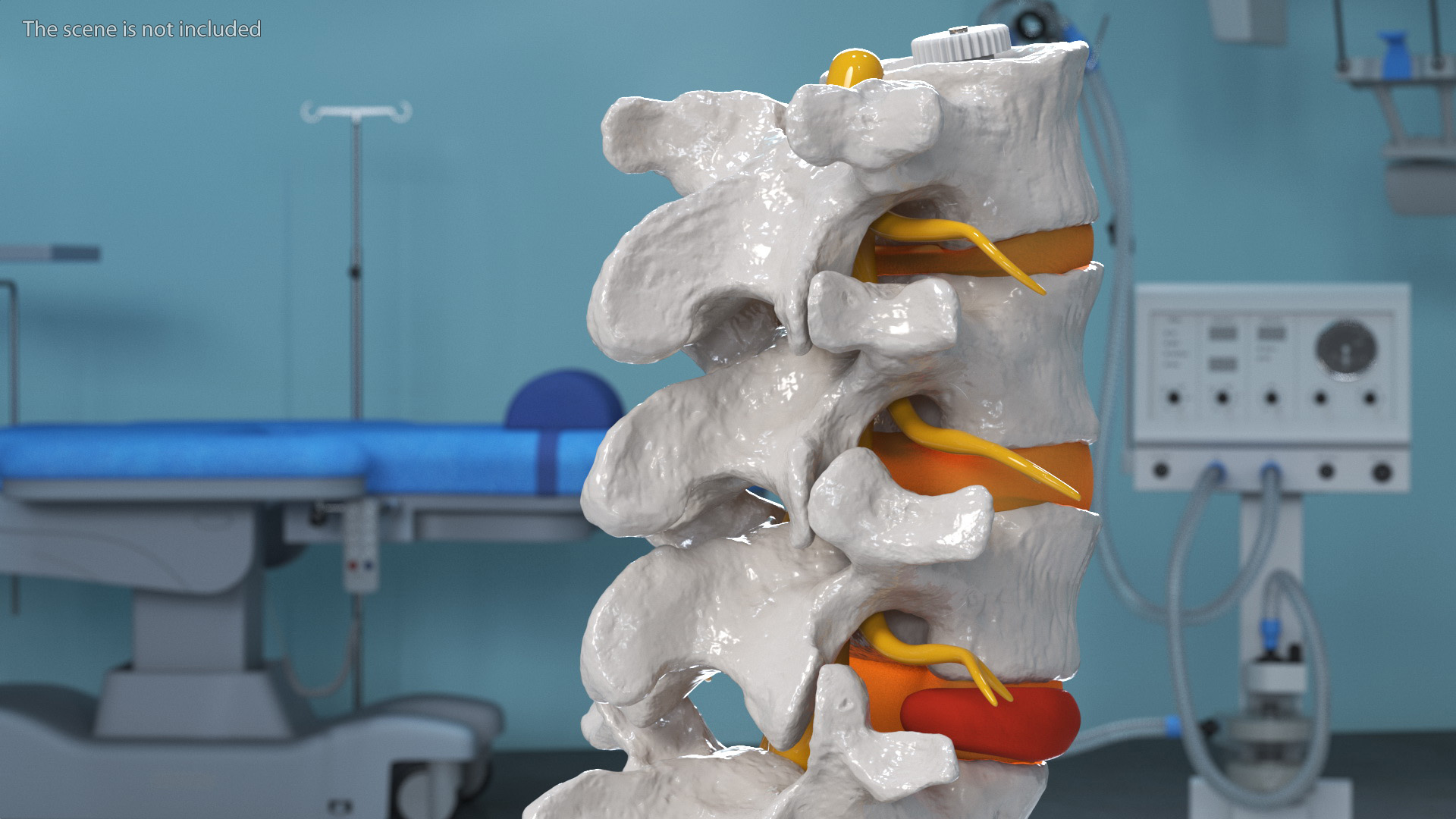 Spinal Column with Hernia on Stand 3D model