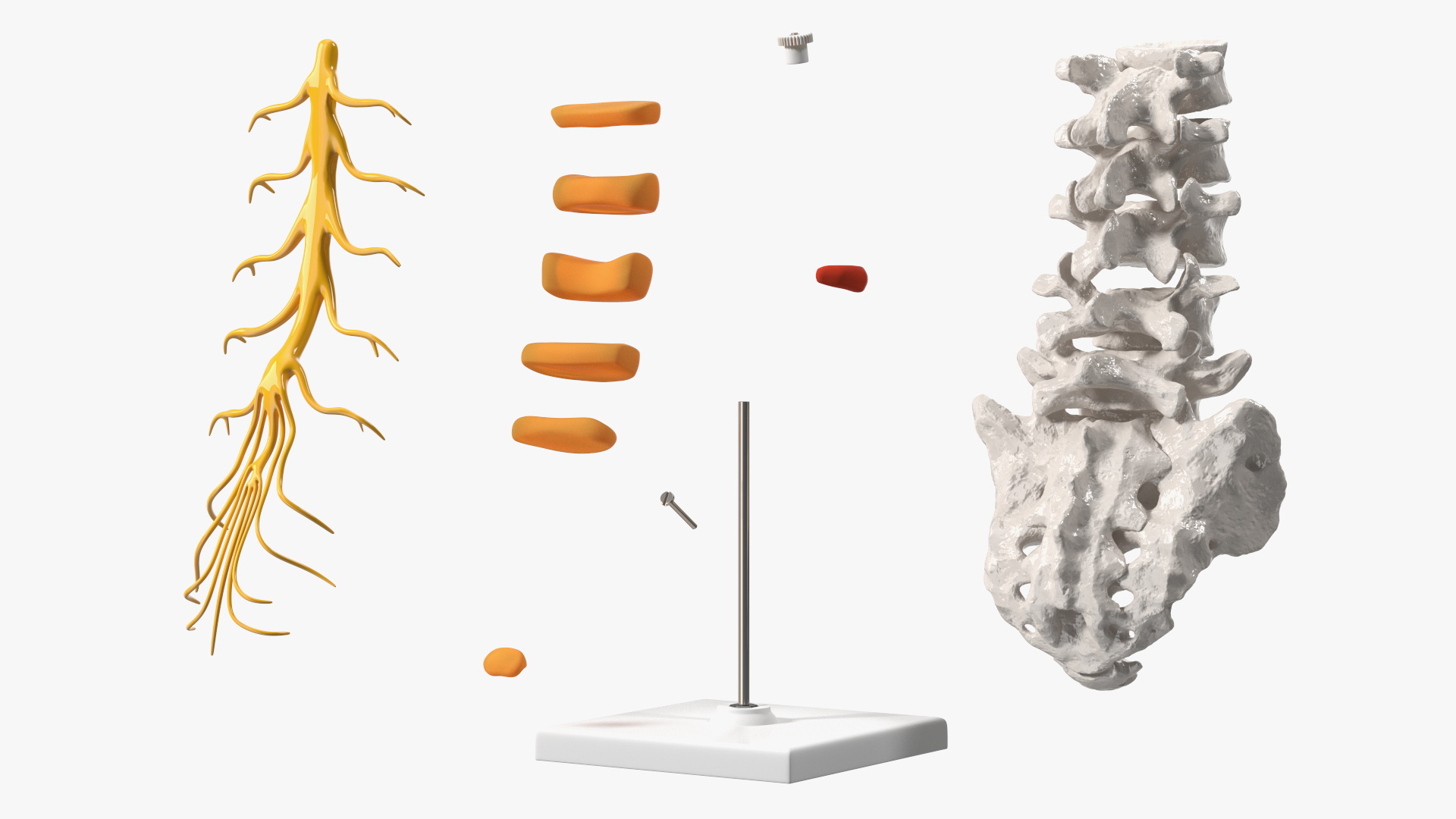 Spinal Column with Hernia on Stand 3D model