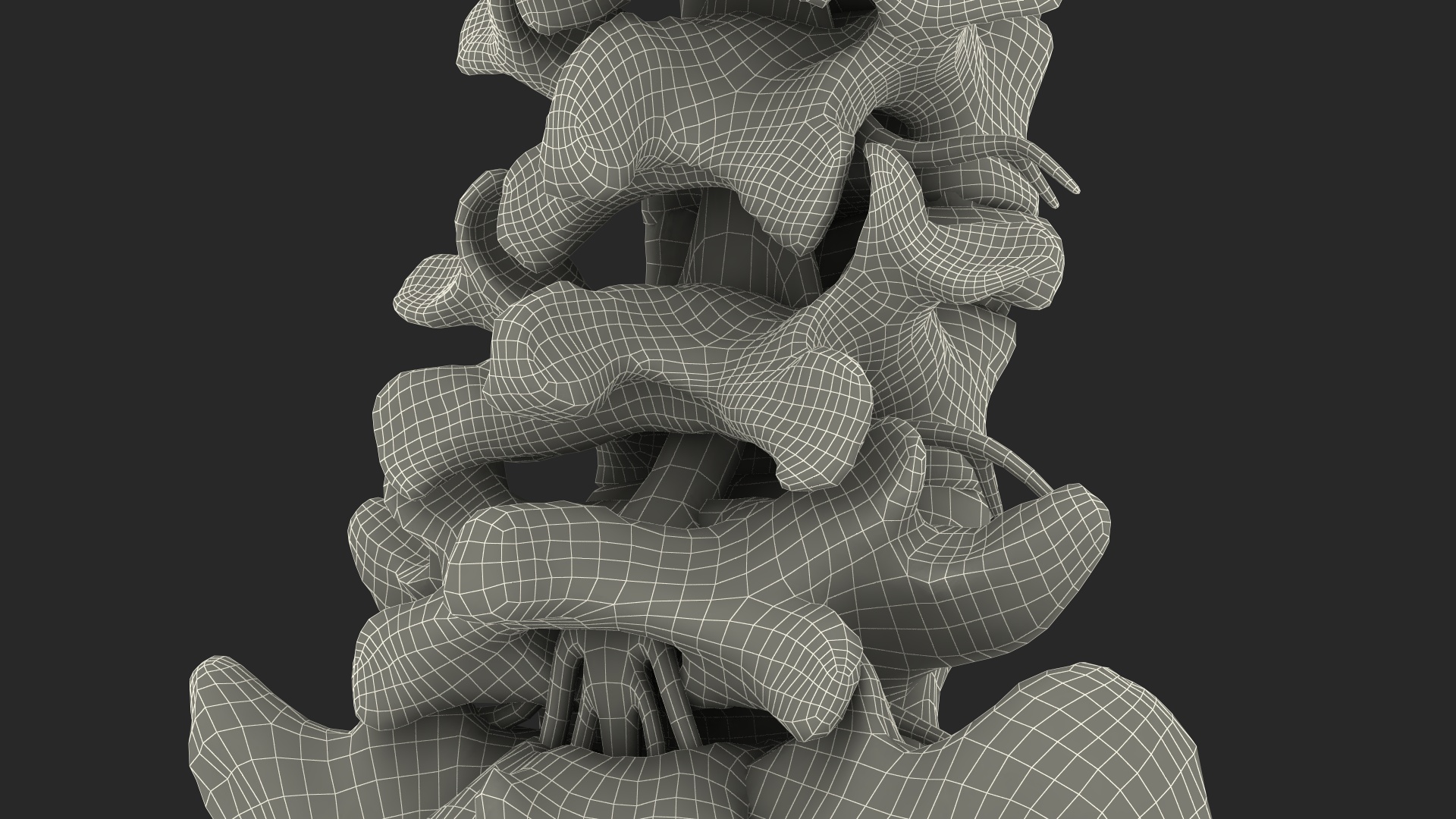 Spinal Column with Hernia on Stand 3D model