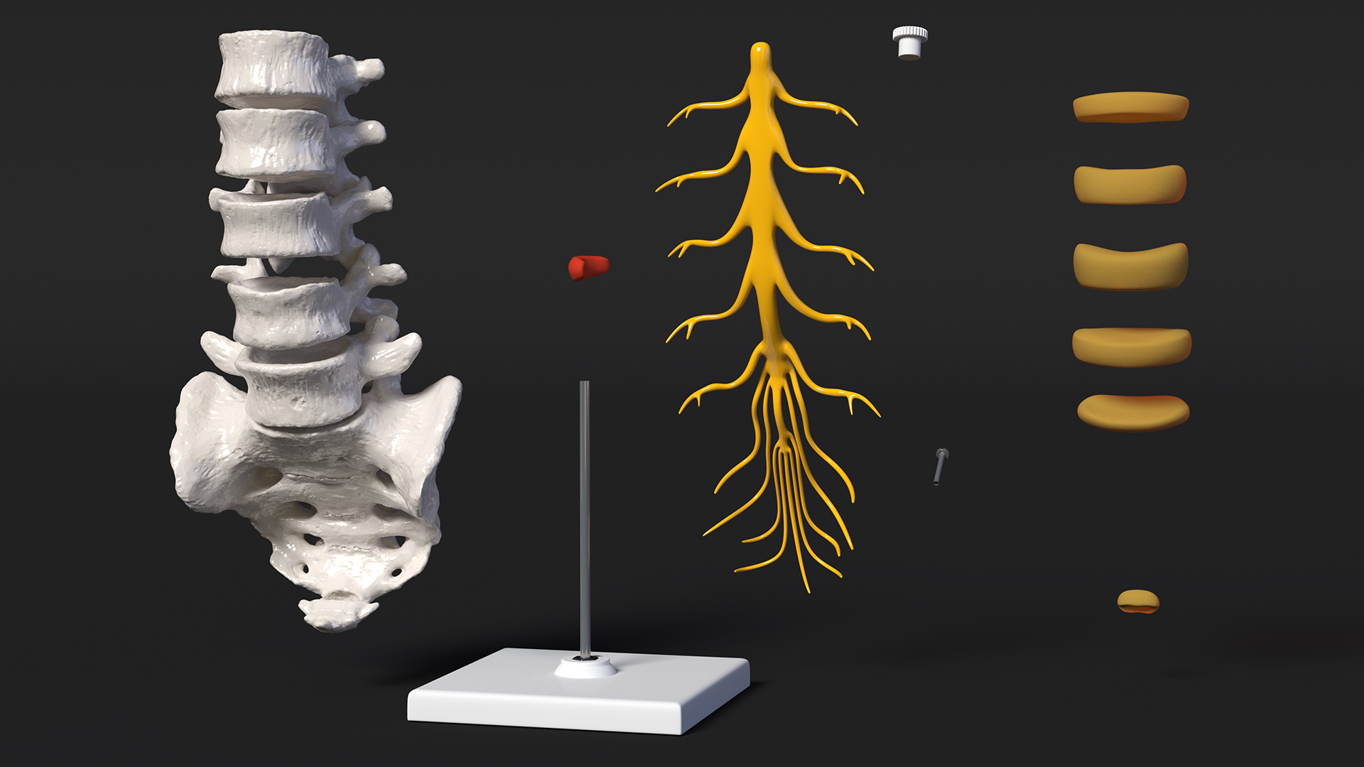 Spinal Column with Hernia on Stand 3D model