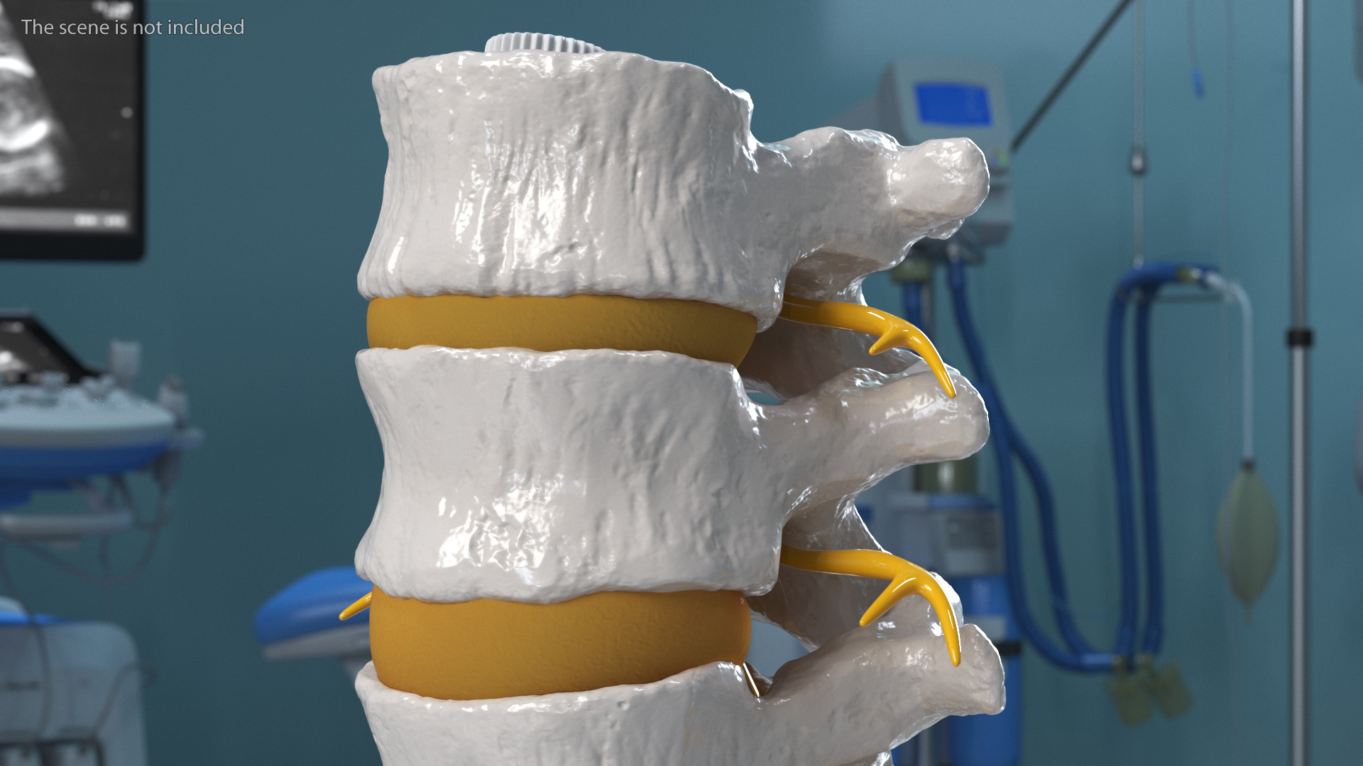 Spinal Column with Hernia on Stand 3D model