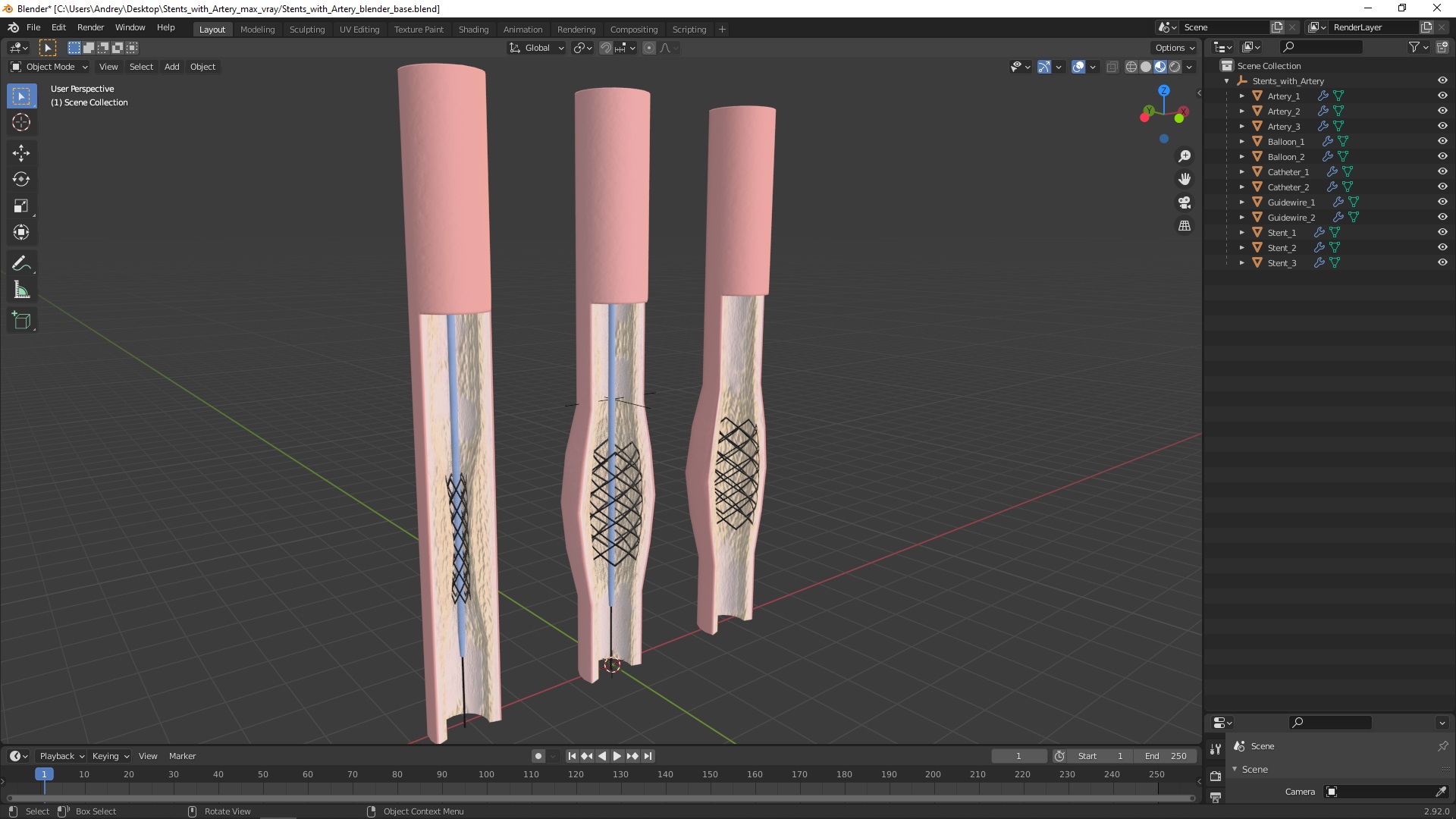 3D Stents with Artery model