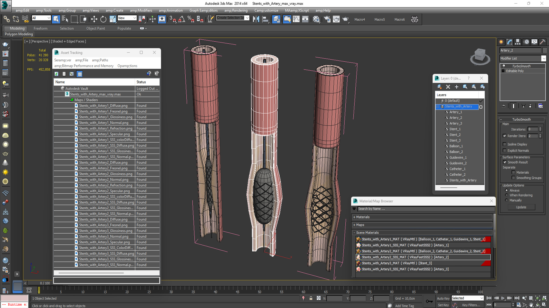 3D Stents with Artery model