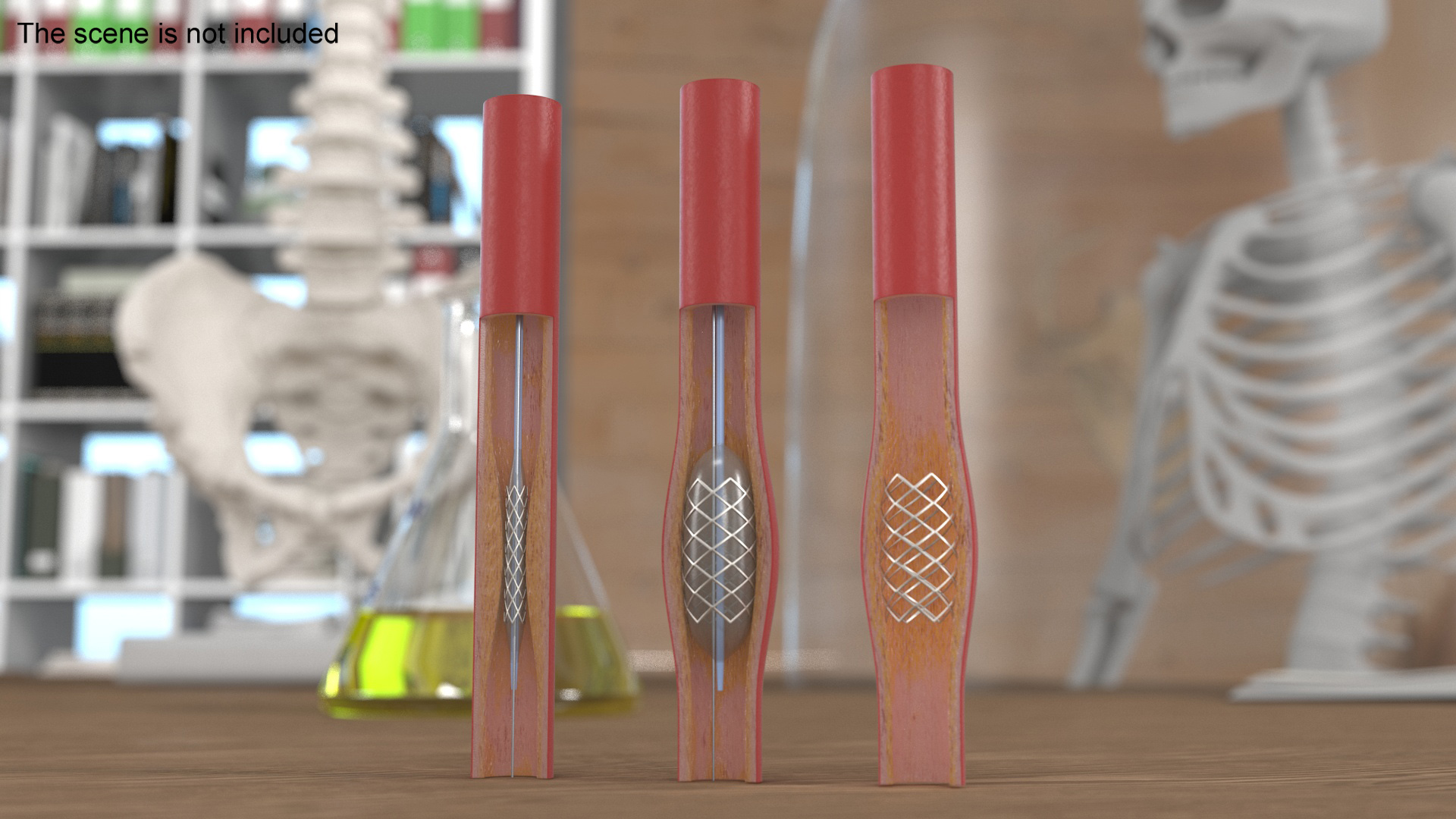 3D Stents with Artery model