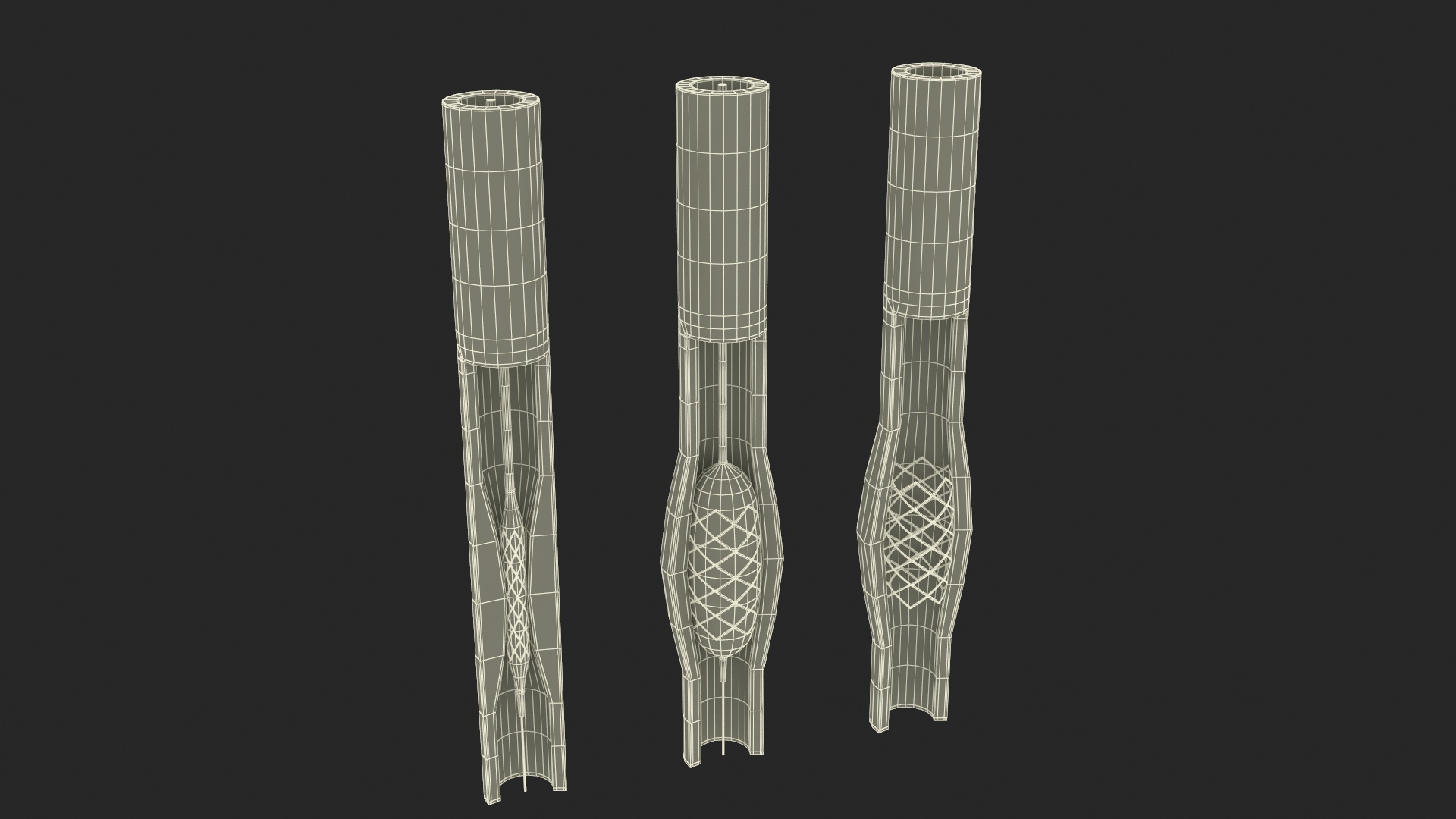 3D Stents with Artery model