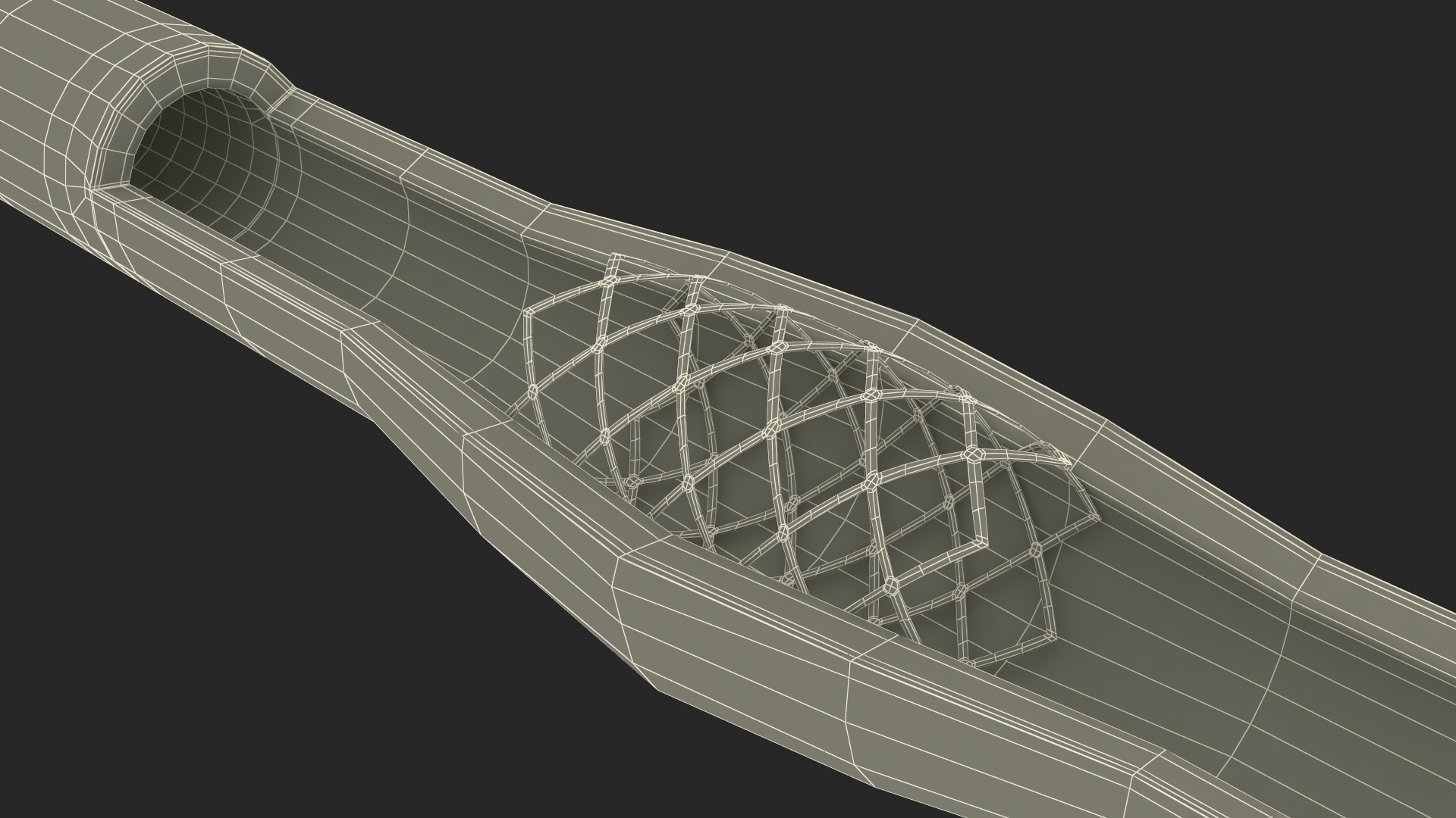 3D Stents with Artery model