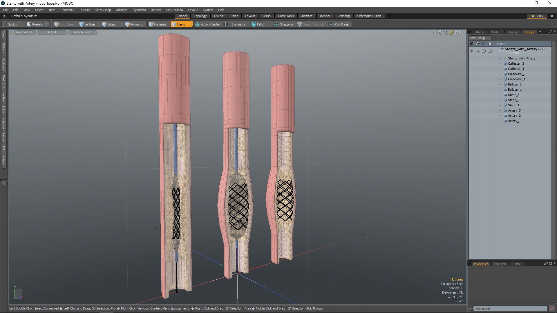 3D Stents with Artery model