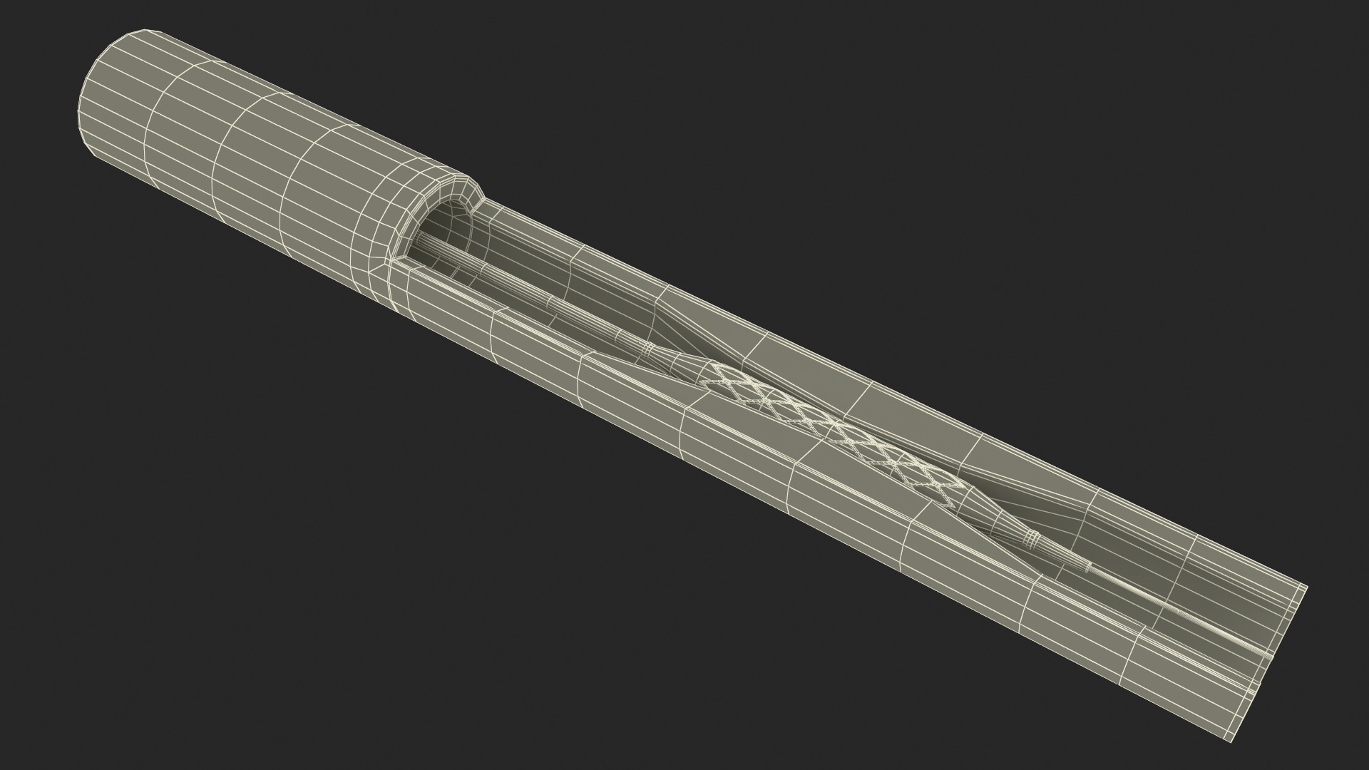 3D Stents with Artery model