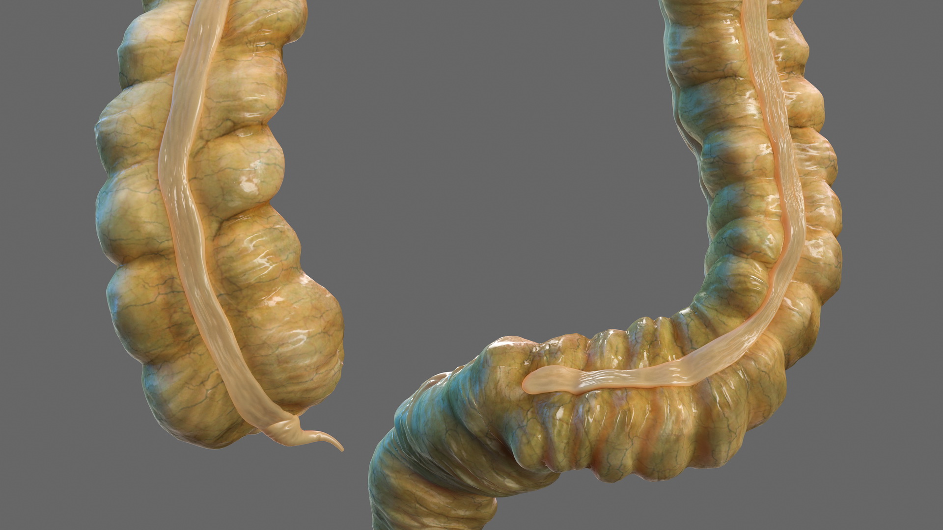 3D Human Small Inestines and Colon