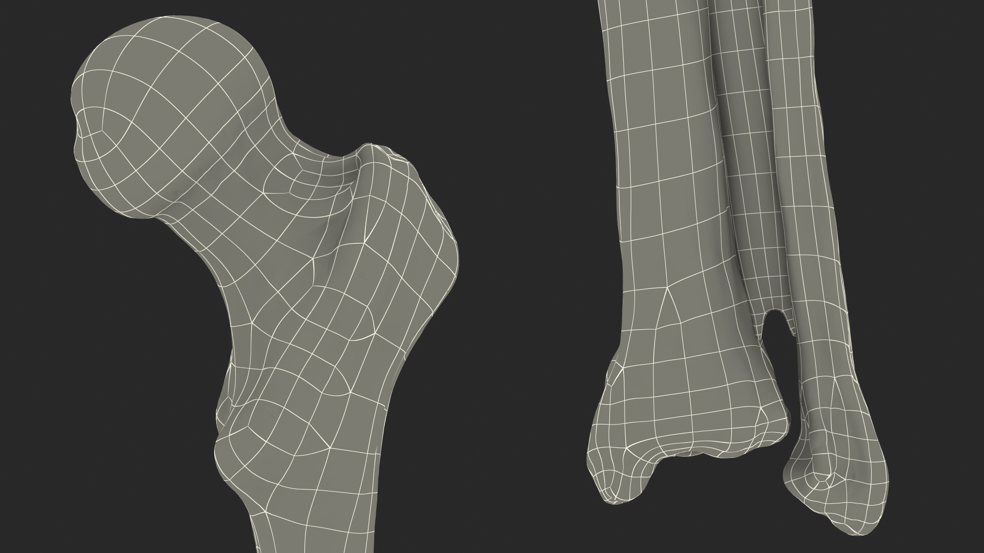 3D Human Knee Bones