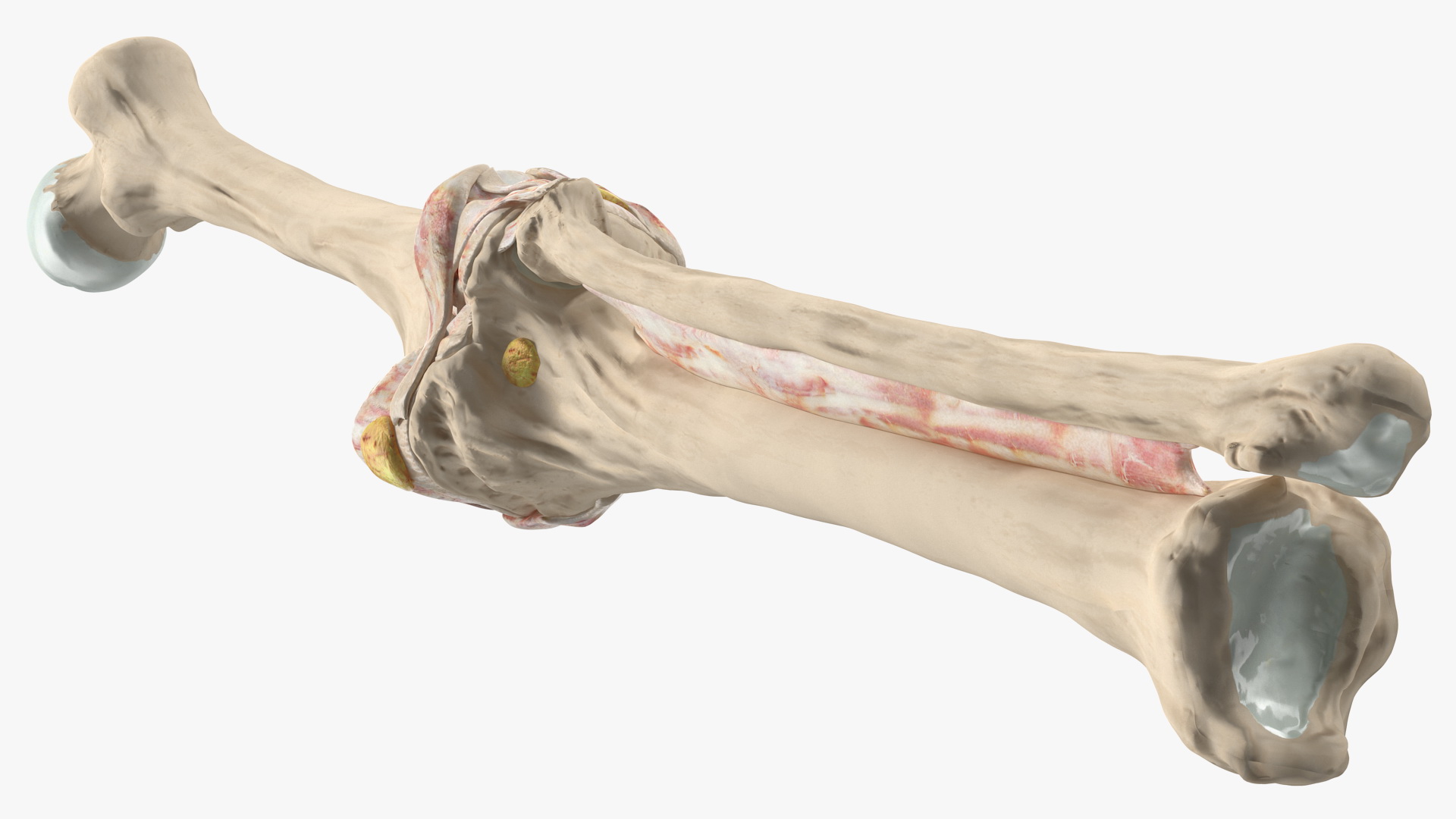 3D Human Knee Bones