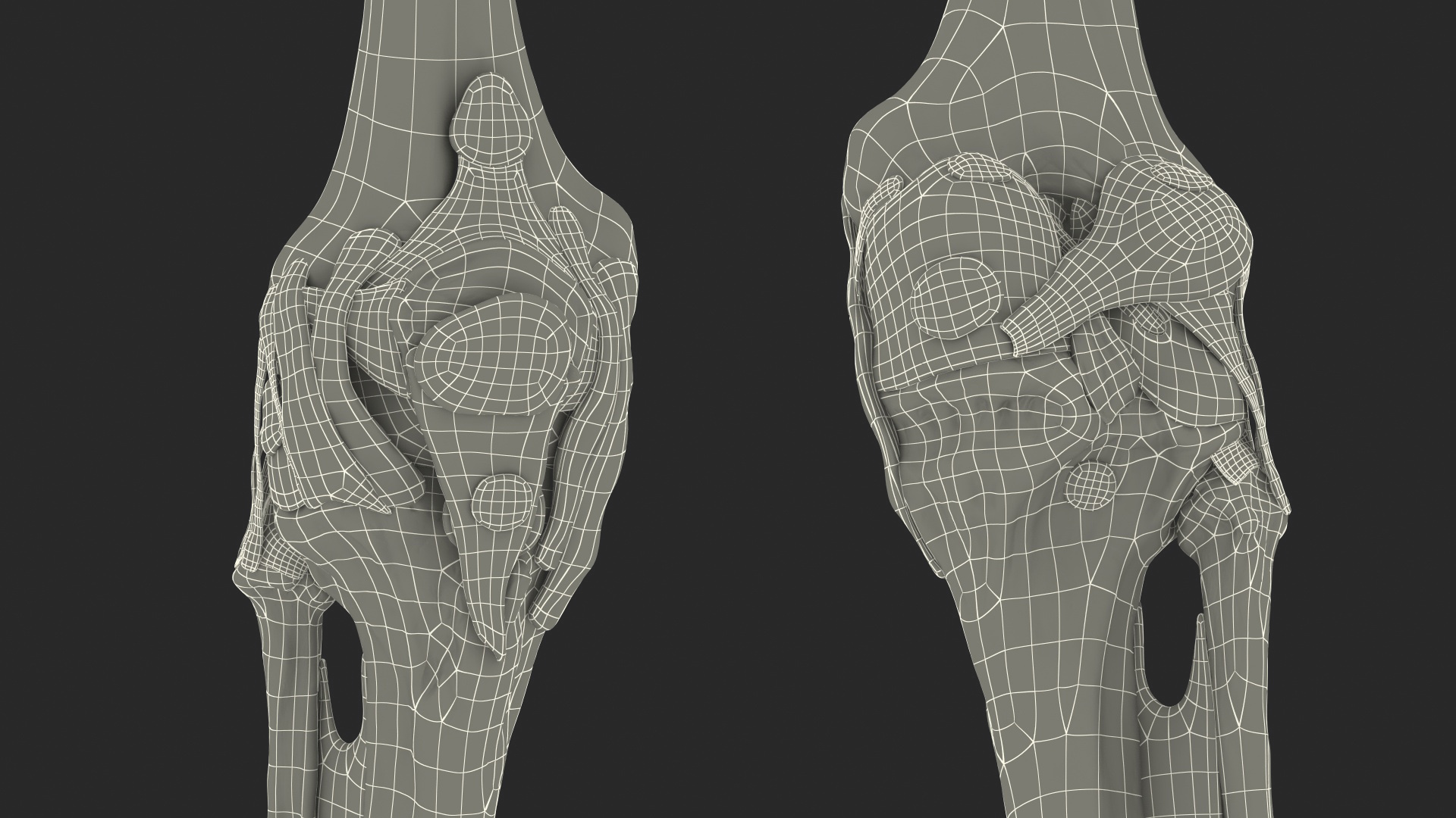 3D Human Knee Bones
