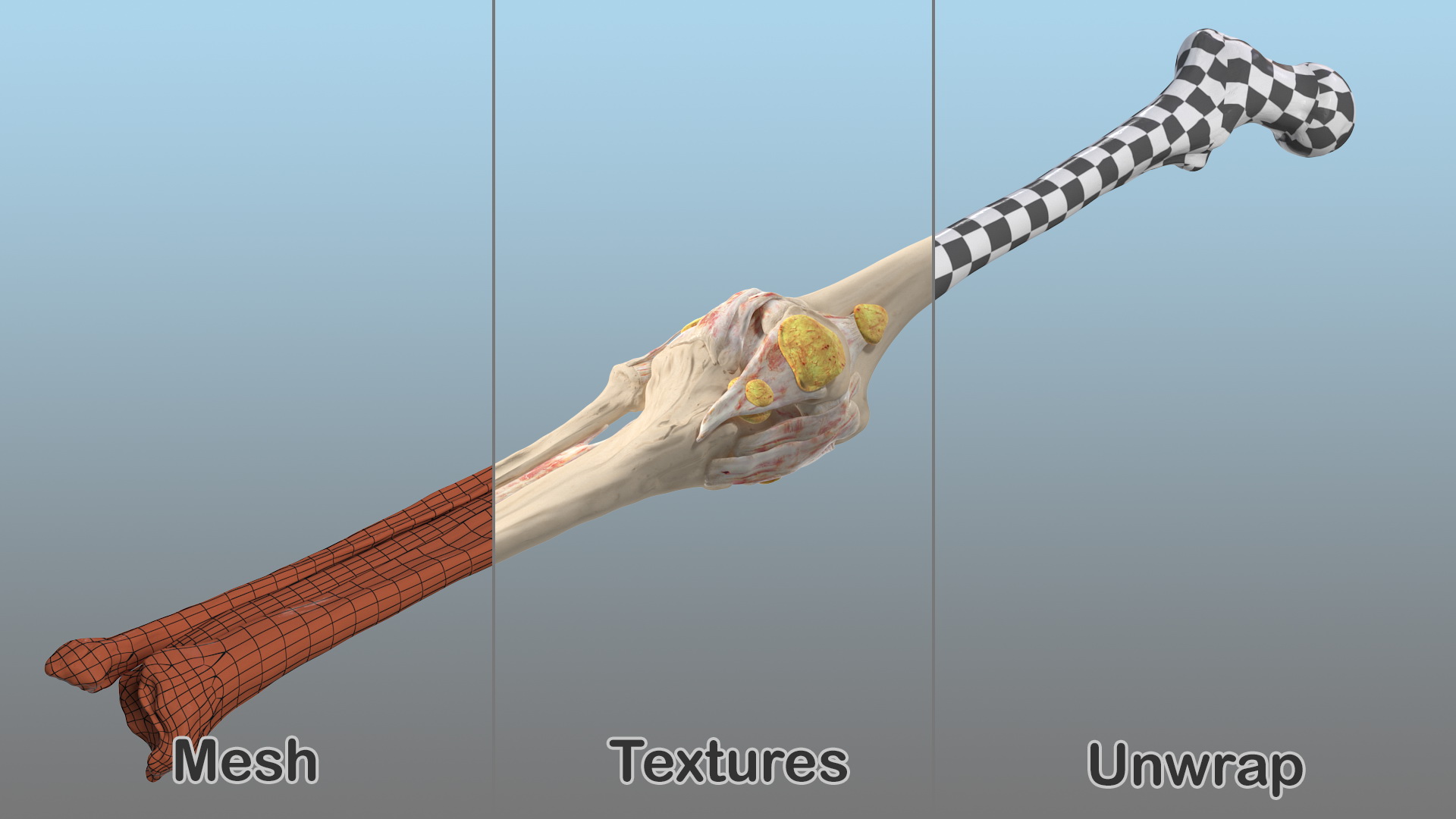 3D Human Knee Bones