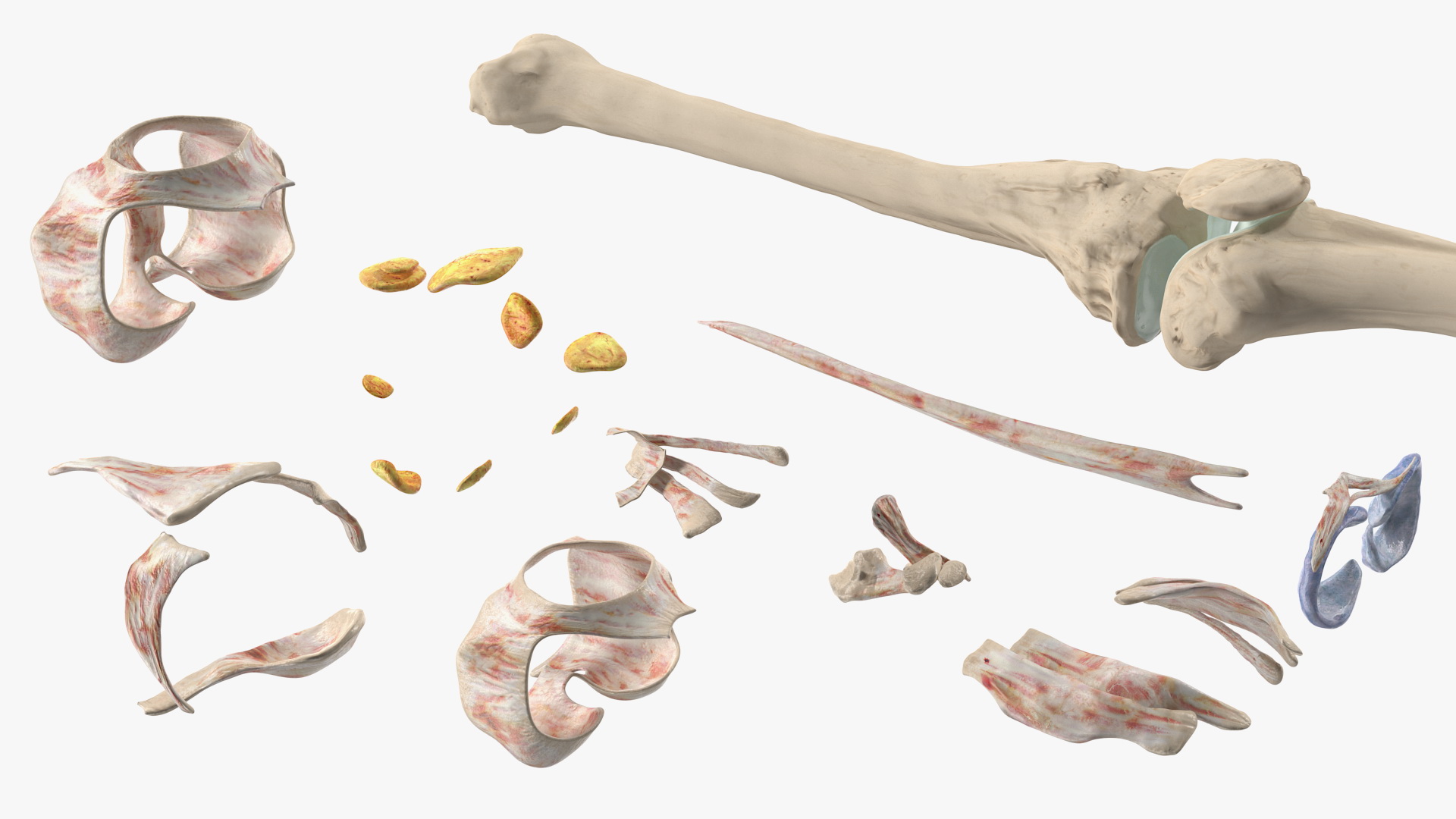 3D Human Knee Bones