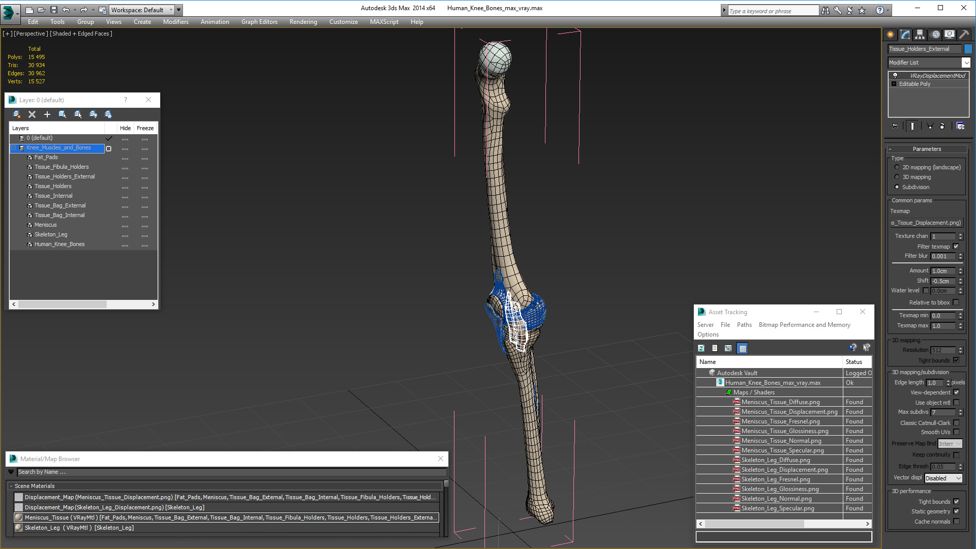 3D Human Knee Bones