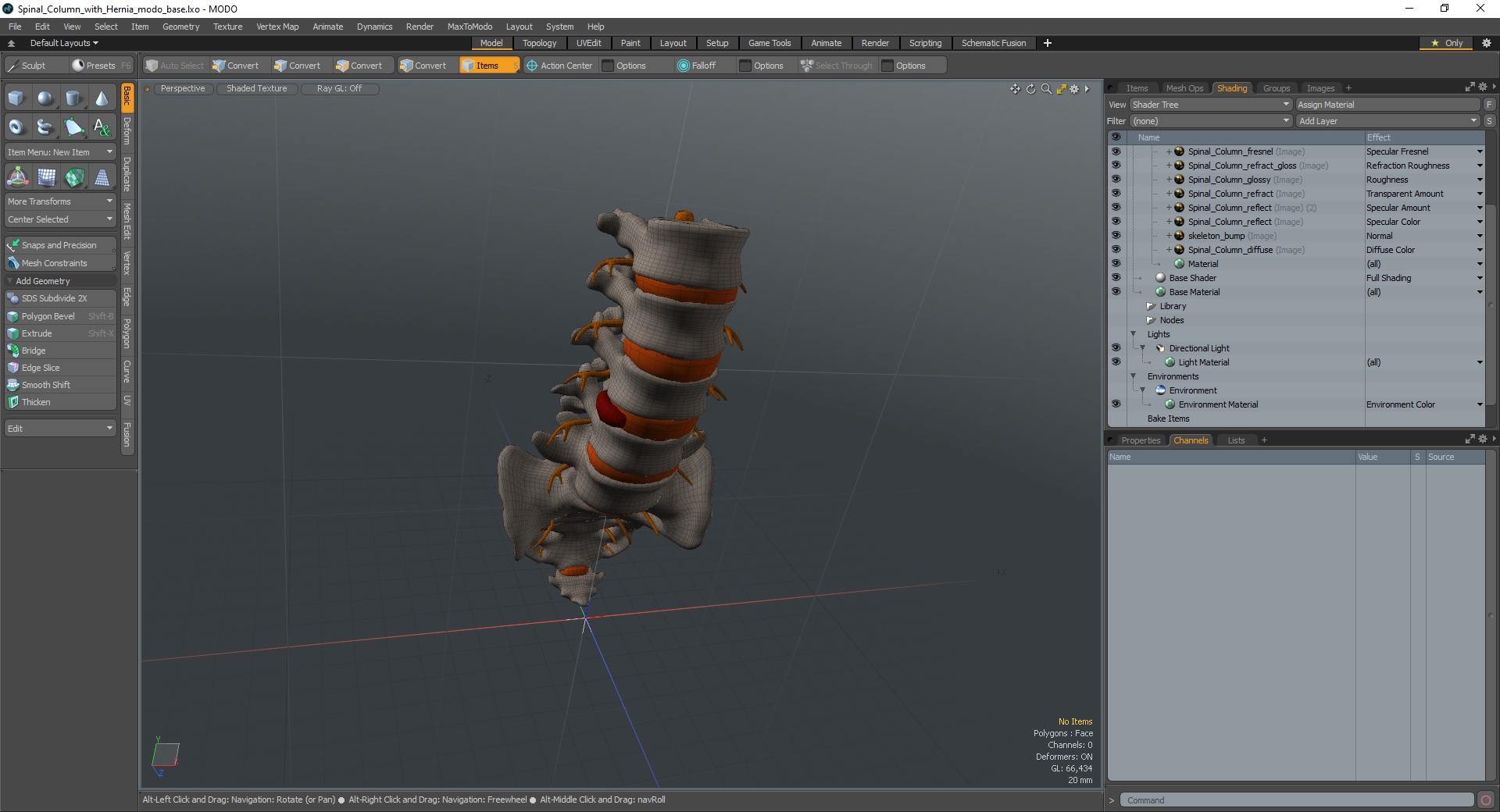 3D model Spinal Column with Hernia