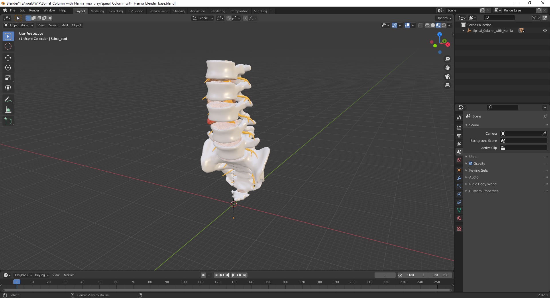 3D model Spinal Column with Hernia