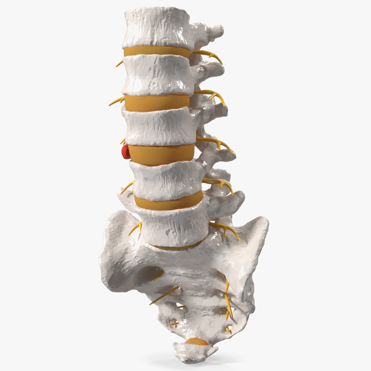 Spinal Column with Hernia, view 8