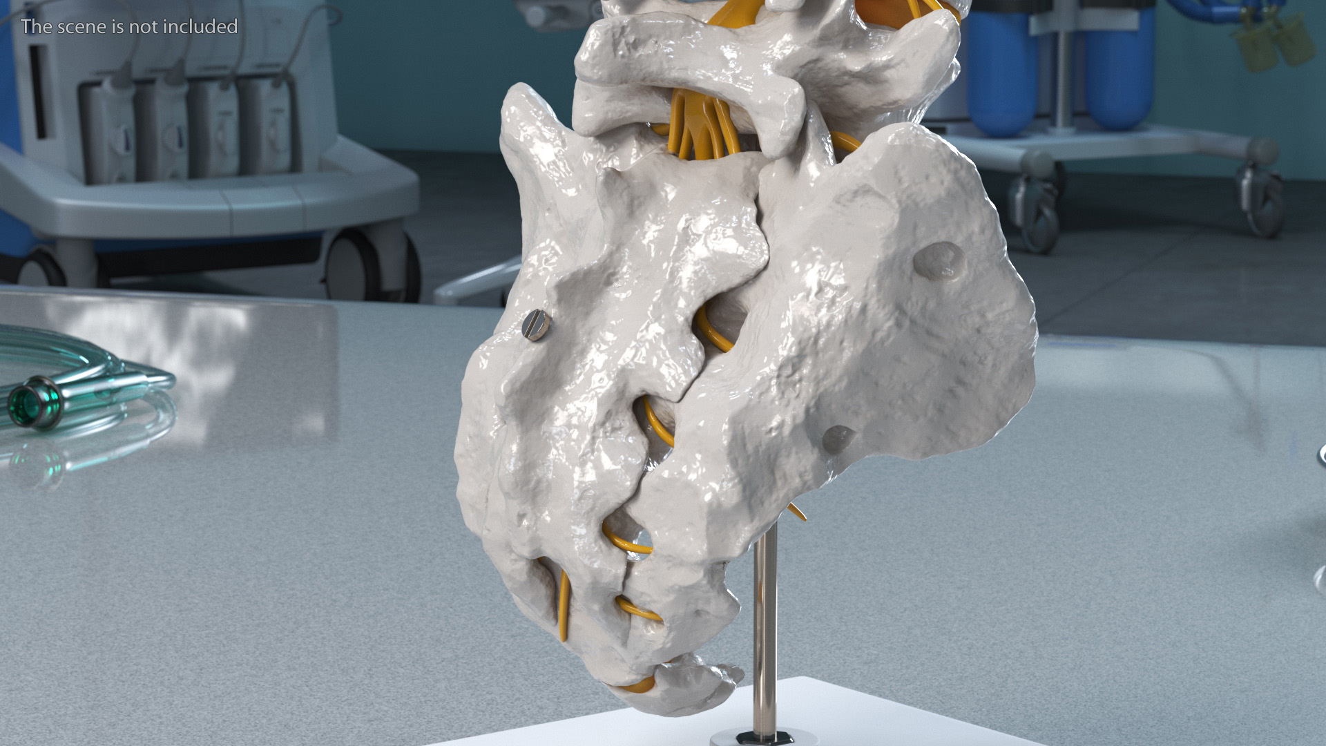 3D model Spinal Column with Hernia