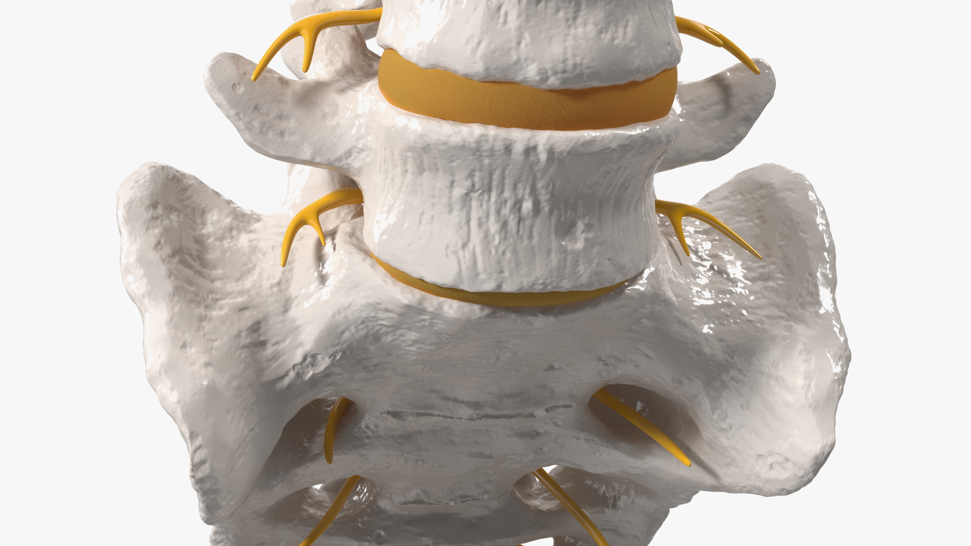 3D model Spinal Column with Hernia