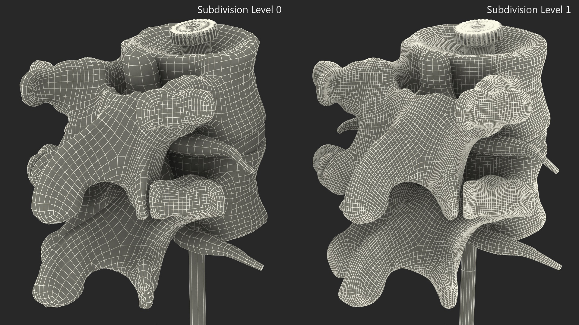 Stand with Herniated Spinal Vertebrae 3D