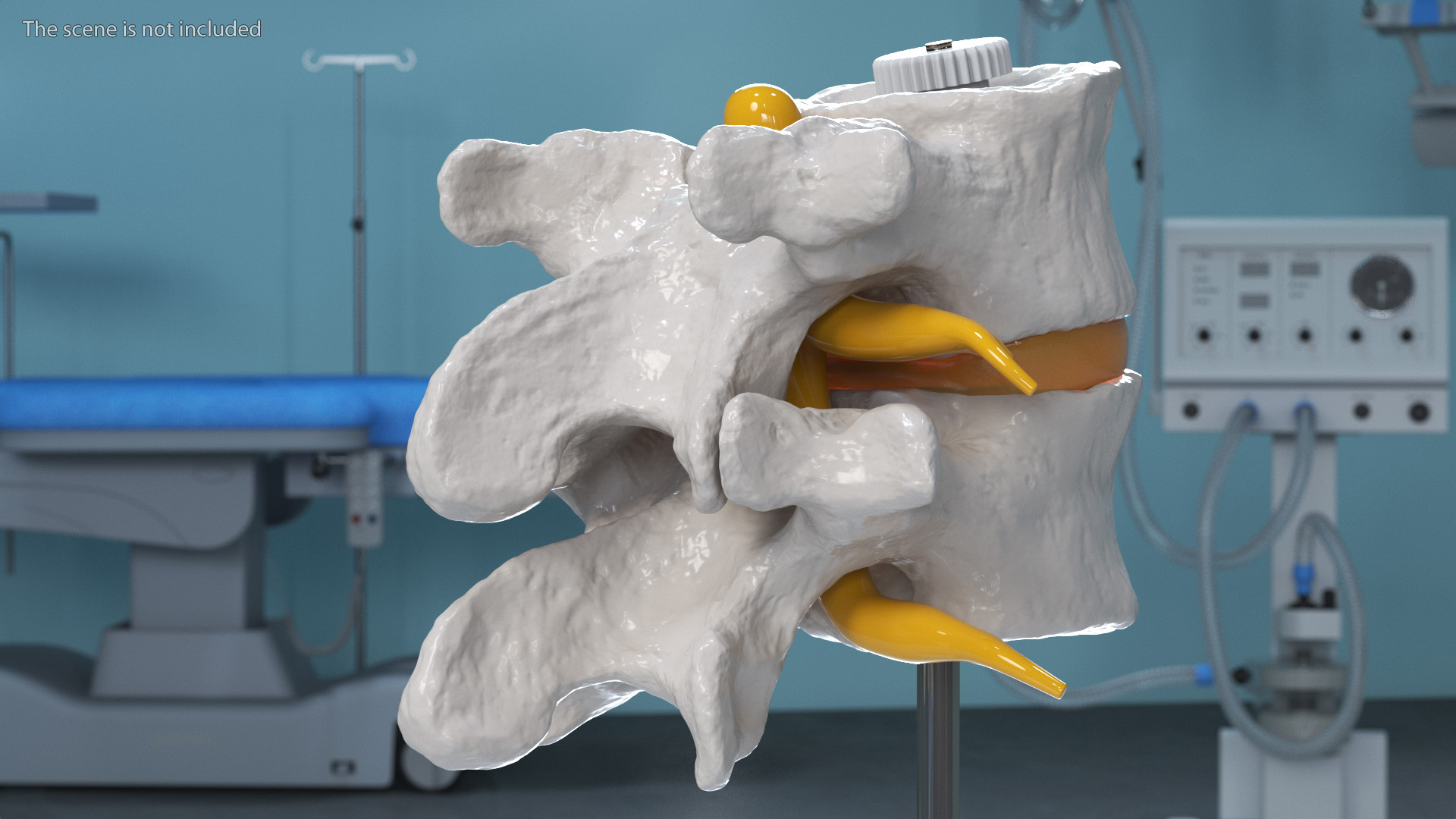 Stand with Herniated Spinal Vertebrae 3D