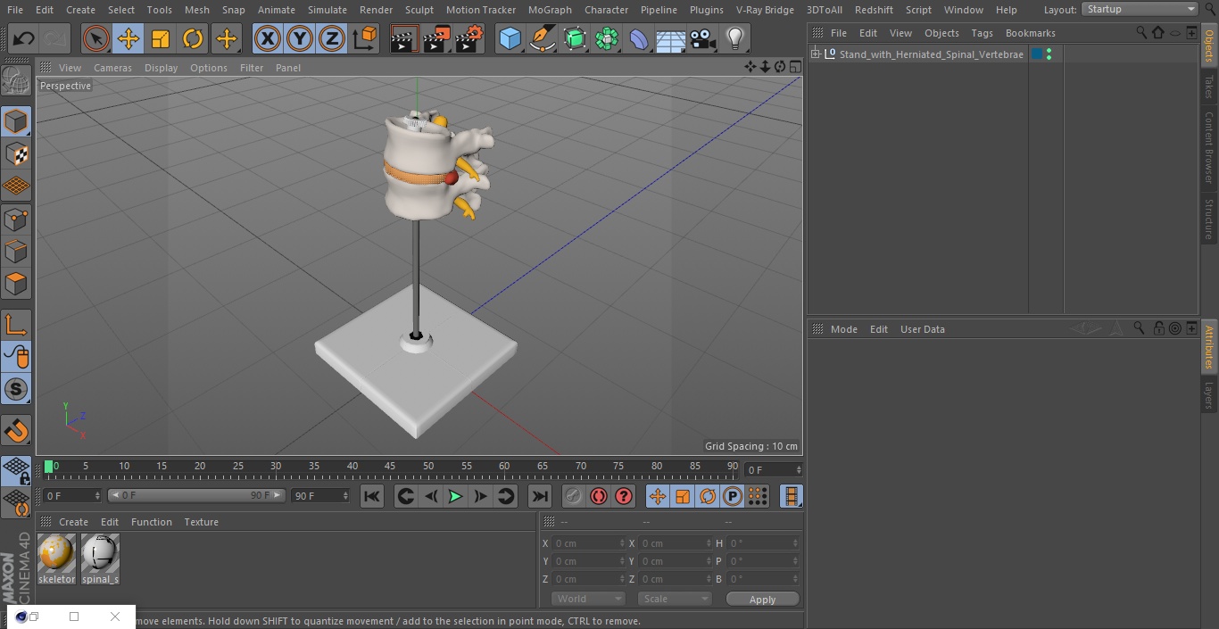 Stand with Herniated Spinal Vertebrae 3D