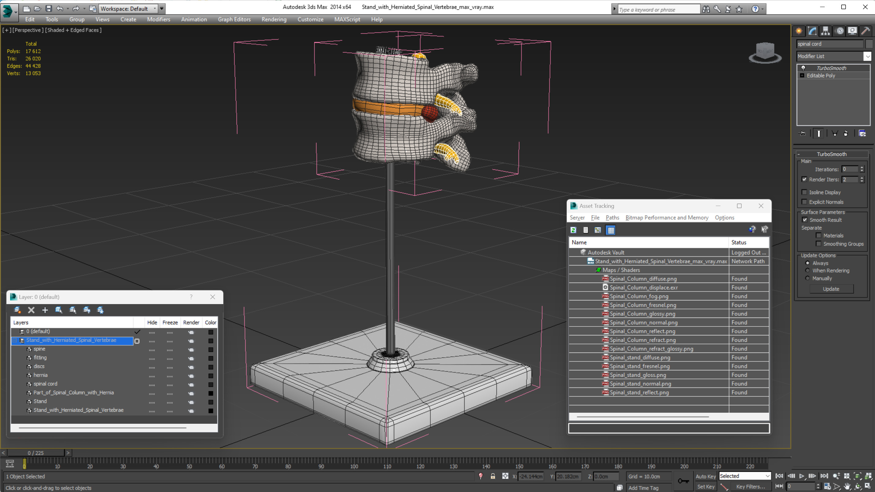 Stand with Herniated Spinal Vertebrae 3D