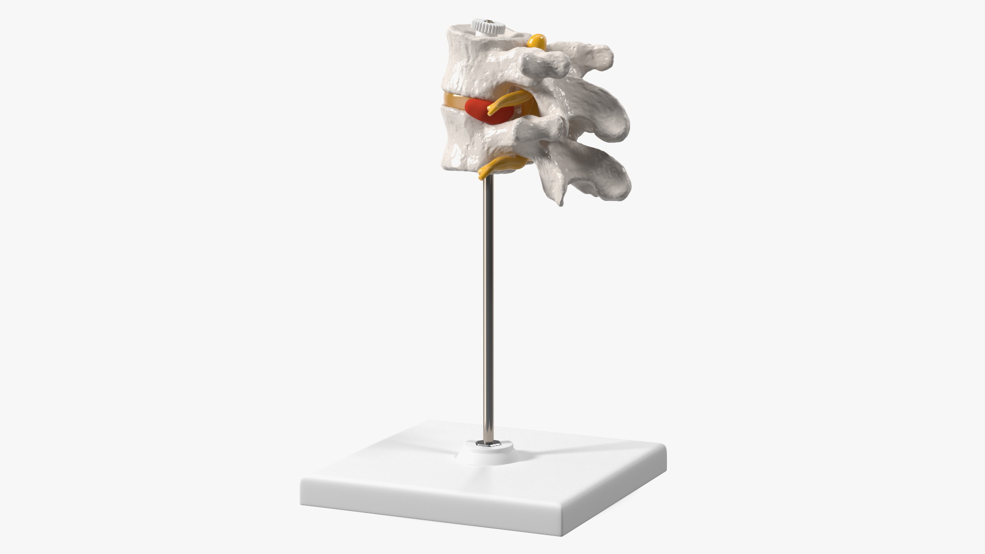 Stand with Herniated Spinal Vertebrae 3D